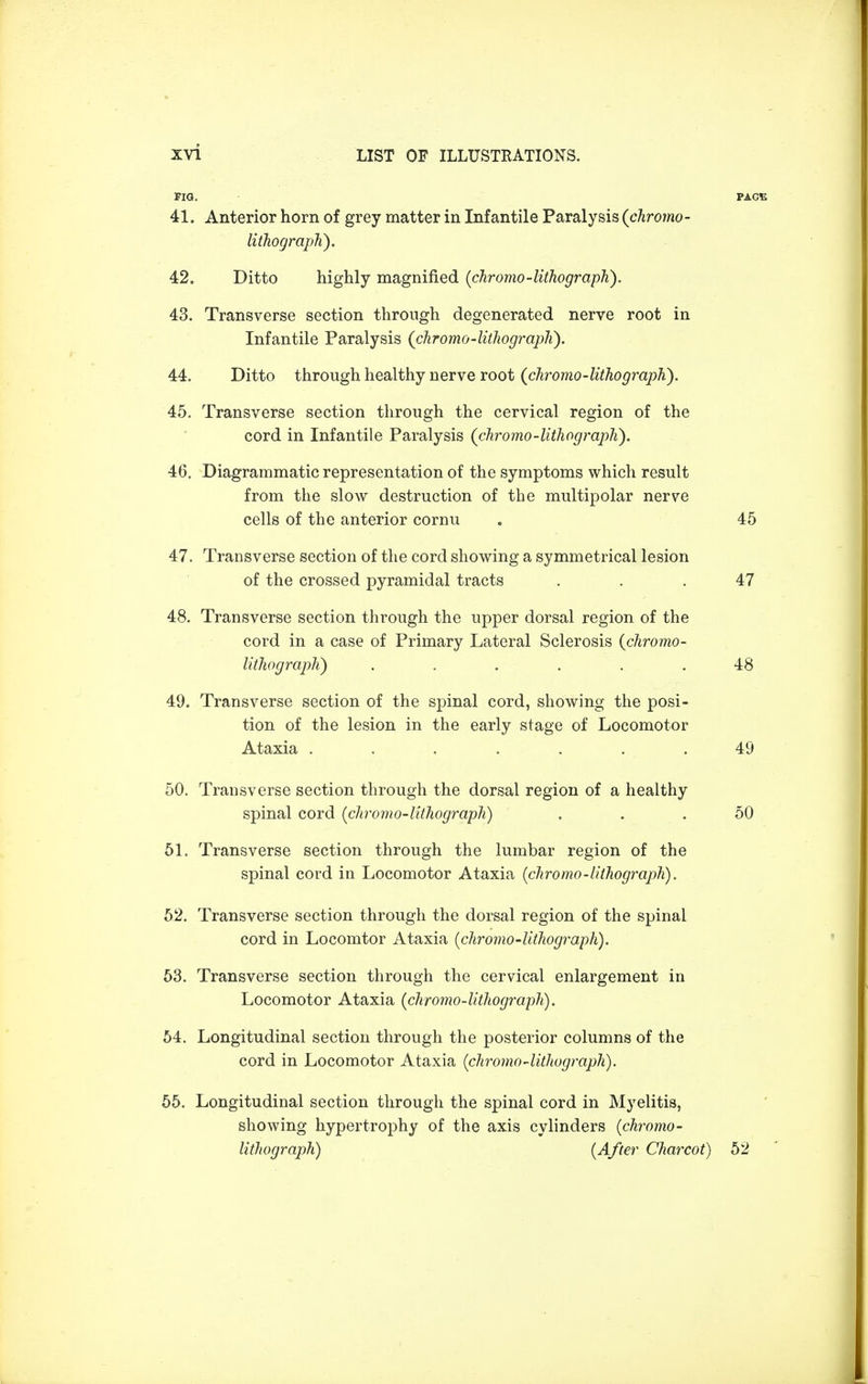 FIG. PACE 41. Anterior horn of grey matter in Infantile Paralysis (chromo- lithograph). 42. Ditto highly magnified (chromo-lithograph). 43. Transverse section through degenerated nerve root in Infantile Paralysis (chromo-lithograph). 44. Ditto through healthy nerve root (chromo-lithograph). 45. Transverse section through the cervical region of the cord in Infantile Paralysis (chromo-lithograph). 46. Diagrammatic representation of the symptoms which result from the slow destruction of the multipolar nerve cells of the anterior cornu . 45 47. Transverse section of the cord showing a symmetrical lesion of the crossed pyramidal tracts ... 47 48. Transverse section through the upper dorsal region of the cord in a case of Primary Lateral Sclerosis (chromo- lithograph) ...... 48 49. Transverse section of the spinal cord, showing the posi- tion of the lesion in the early stage of Locomotor Ataxia . . . . . . . 49 50. Transverse section through the dorsal region of a healthy spinal cord {chromo-lithograph) . . 50 51. Transverse section through the lumbar region of the spinal cord in Locomotor Ataxia (chromo-lithograph). 52. Transverse section through the dorsal region of the spinal cord in Locomtor Ataxia {chromo-lithograph). 53. Transverse section through the cervical enlargement in Locomotor Ataxia (chromo-lithograph). 54. Longitudinal section through the posterior columns of the cord in Locomotor Ataxia (chromo-lithograph). 55. Longitudinal section through the spinal cord in Myelitis, showing hypertrophy of the axis cylinders (chromo- lithograph) (After Charcot) 52