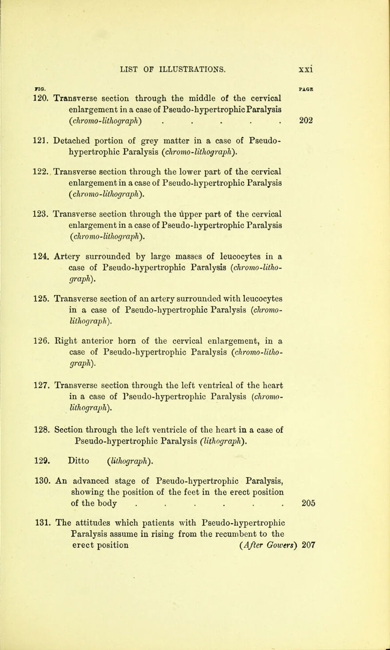 FIG. PAGE 120. Transverse section through the middle of the cervical enlargement in a case of Pseudo-hypertrophic Paralysis (chromo-lithograph) . 202 121. Detached portion of grey matter in a case of Pseudo- hypertrophic Paralysis (chromo-lithograph). 122. Transverse section through the lower part of the cervical enlargement in a case of Pseudo-hypertrophic Paralysis (chromo-lithograph). 123. Transverse section through the upper part of the cervical enlargement in a case of Pseudo-hypertrophic Paralysis (ch ro mo- lithograph). 124. Artery surrounded by large masses of leucocytes in a case of Pseudo-hypertrophic Paralysis (chromo-litho- graph). 125. Transverse section of an artery surrounded with leucocytes in a case of Pseudo-hypertrophic Paralysis (chromo- lithograph). 126. Right anterior horn of the cervical enlargement, in a case of Pseudo-hypertrophic Paralysis (chromo-litho- graph). 127. Transverse section through the left ventrical of the heart in a case of Pseudo-hypertrophic Paralysis (chromo- lithograph). 128. Section through the left ventricle of the heart in a case of Pseudo-hypertrophic Paralysis (lithograph). 129. Ditto (lithograph). 130. An advanced stage of Pseudo-hypertrophic Paralysis, showing the position of the feet in the erect position of the body ...... 205 131. The attitudes which patients with Pseudo-hypertrophic Paralysis assume in rising from the recumbent to the erect position (After Gowers) 207