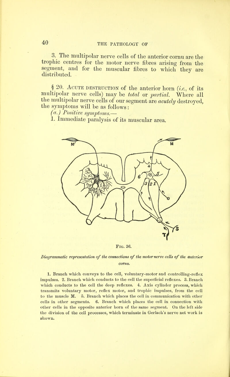 3. The multipolar nerve cells of the anterior cornu are the trophic centres for the motor nerve fibres arising from the segment, and for the muscular fibres to which they are distributed. § 20. Acute destkuction of the anterior horn (i.e., of its multipolar nerve cells) may be total or partial. Where all the multipolar nerve cells of our segment are acutely destroyed, the symptoms will be as follows: (a.) Positive symptoms.— 1. Immediate paralysis of its muscular area. Fig. 36. Diagrammatic representation of the connections of the motor nerve cells of the anterior cornu. 1. Branch which conveys to the cell, voluntary-motor and controlling-reflex impulses. 2. Branch which conducts to the cell the superficial reflexes. 3. Branch which conducts to the cell the deep reflexes. 4. Axis cylinder process, which transmits voluntary motor, reflex motor, and trophic impulses, from the cell to the muscle M. 5. Branch which places the cell in communication with other cells in other segments. 6. Branch which places the cell in connection with other cells iu the opposite anterior horn of the same segment. On the left side the division of the cell processes, which terminate in Gerlaeh's nerve net Mrork is shown.