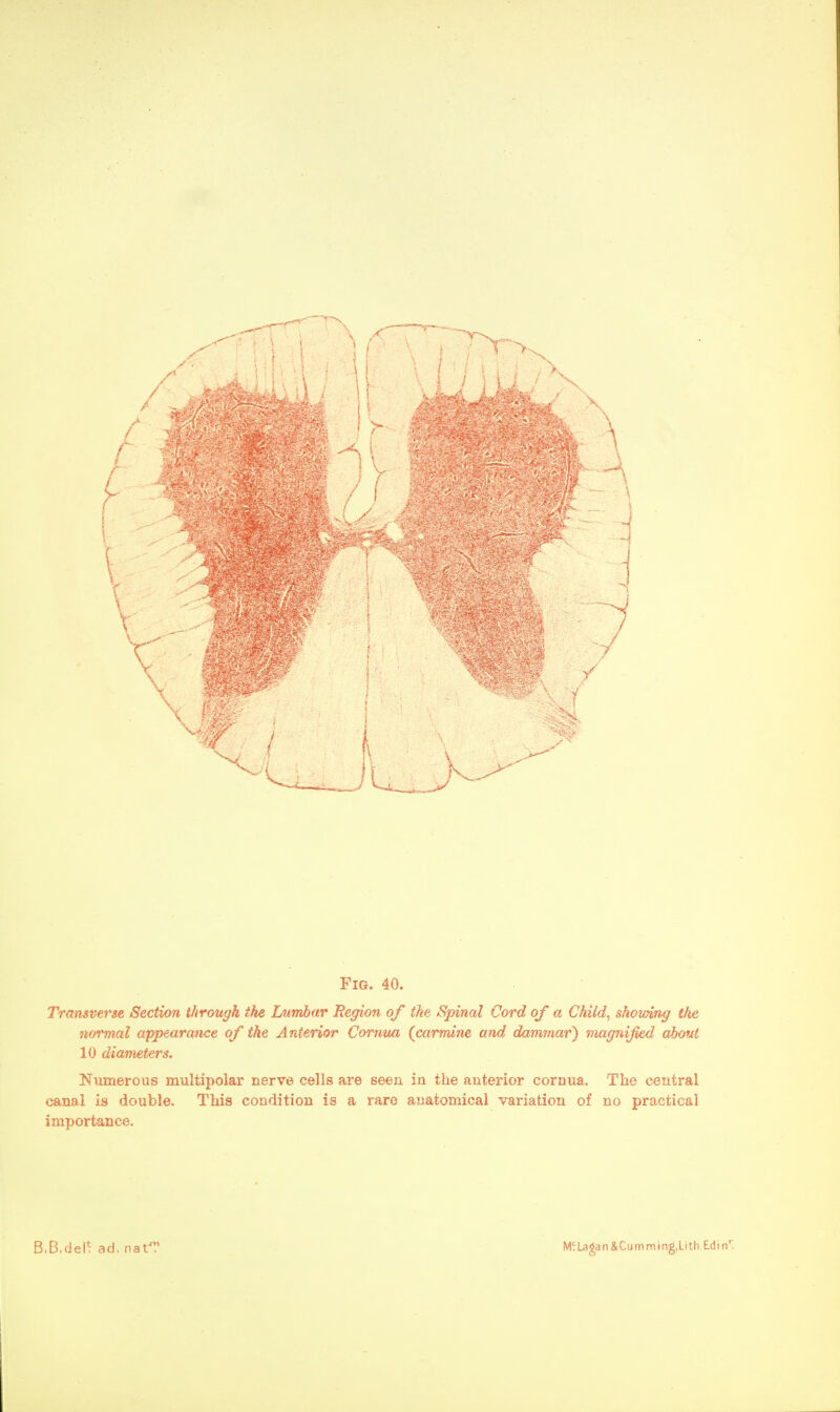 X Fro. 40. Transverse Section through the Lumbar Region of the Spinal Cord of a Child, showing the normal appearance of the Anterior Comua (carmine and dammar) magnified about 10 diameters. Numerous multipolar nerve cells are seen in the anterior cornua. The central canal is double. This condition is a rare anatomical variation of no practical importance.