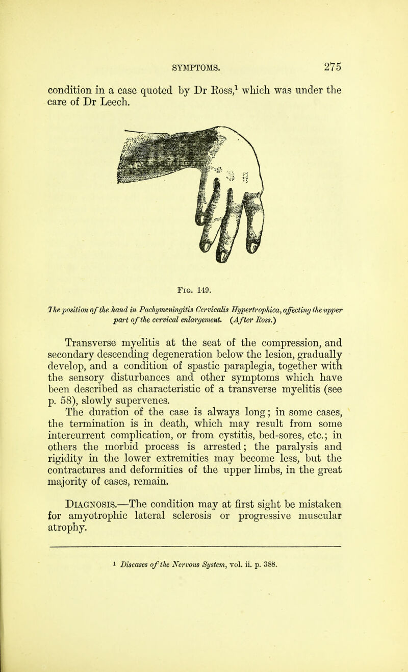 condition in a case quoted by Dr Boss,1 which was under the care of Dr Leech. Fig. 149. The position o f the, hand in Pachymeningitis Cervicalis Hypertrophica, affecting the upper part of the cervical enlargement. (After Ross.) Transverse myelitis at the seat of the compression, and secondary descending degeneration below the lesion, gradually develop, and a condition of spastic paraplegia, together with the sensory disturbances and other symptoms which have been described as characteristic of a transverse myelitis (see p. 58), slowly supervenes. The duration of the case is always long; in some cases, the termination is in death, which may result from some intercurrent complication, or from cystitis, bed-sores, etc.; in others the morbid process is arrested; the paralysis and rigidity in the lower extremities may become less, but the contractures and deformities of the upper limbs, in the great majority of cases, remain. Diagnosis.—The condition may at first sight be mistaken for amyotrophic lateral sclerosis or progressive muscular atrophy. 1 Diseases of the Nervous System, vol. ii. p. 388.