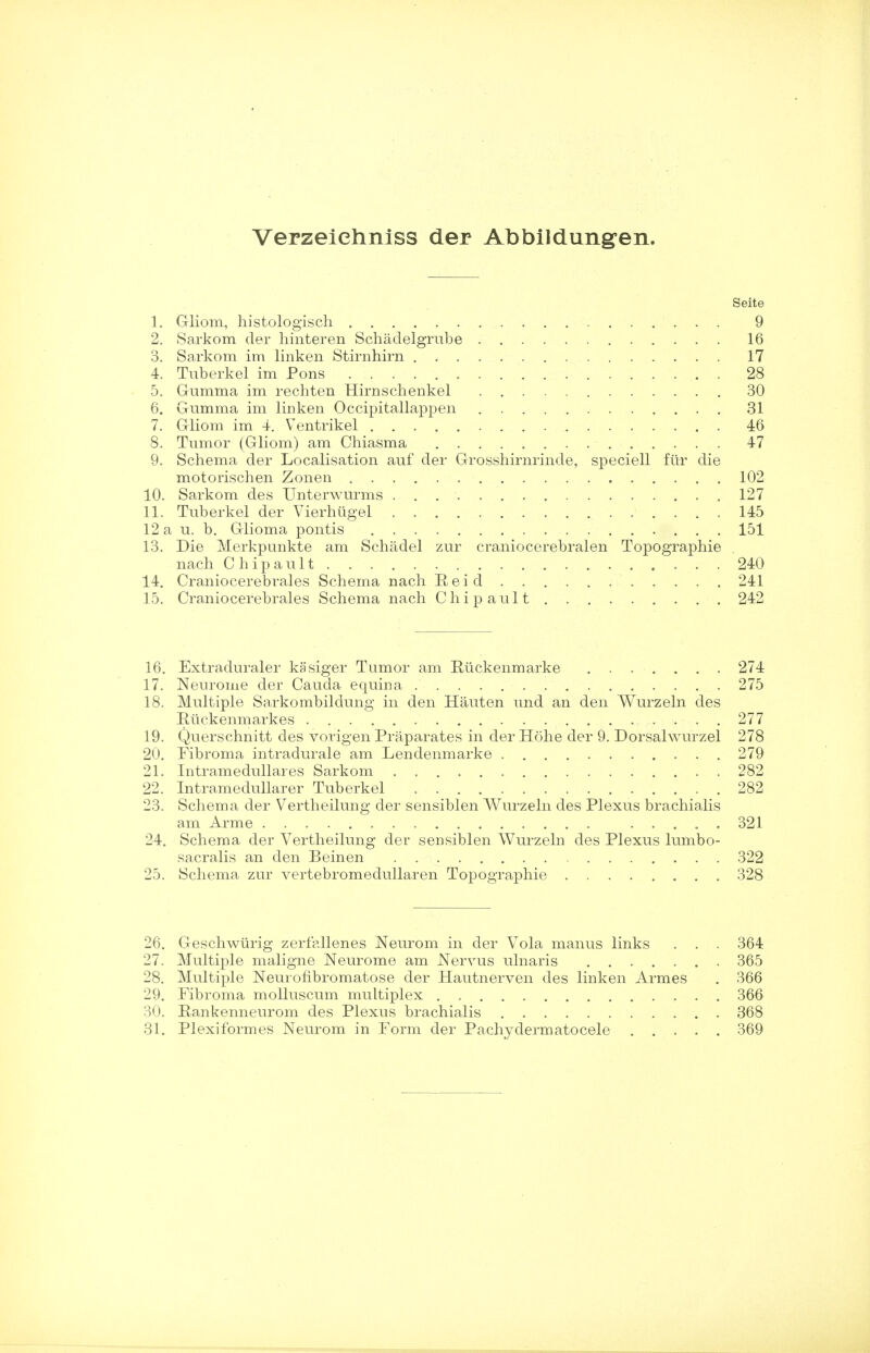 Verzeiehniss der Abbildungen. Seite 1. G-liom, histologisch 9 2. Sarkom der hinteren Schadelgrube 16 3. Sarkom im linken Stirnhirn 17 4. Tuberkel im Pons 28 5. Gumma im rechten Hirnschenkel 30 6. Gumma im linken Occipitallappen 31 7. Gliom im 4. Ventrikel 46 8. Tumor (Gliom) am Chiasma 47 9. Schema der Localisation auf der Grosshirnrinde, speciell fur die motorischen Zonen 102 10. Sarkom des Unterwurms . . 127 11. Tuberkel der Vierhiigel 145 12 a u. b. Glioma pontis 151 13. Die Merkpunkte am Schadel zur craniocerebralen Topographie nach Chipault 240 14. Craniocerebrales Schema nach Re id 241 15. Craniocerebrales Schema nach Chipault 242 16. Extraduraler kasiger Tumor am Riickenmarke ....... 274 17. Neurome der Cauda equina 275 18. Multiple Sarkombildung in den Hauten und an den Wurzeln des Rtickenmarkes 277 19. Querschnitt des vorigen Praparates in der Hohe der 9. Dorsalwurzel 278 20. Fibroma intradurale am Lendenmarke 279 21. Intramedullares Sarkom 282 22. Intramedullarer Tuberkel 282 23. Schema der Vertheilung der sensiblen Wurzeln des Plexus brachialis am Arme 321 24. Schema der Vertheilung der sensiblen Wurzeln des Plexus lumbo- sacralis an den Beinen 322 25. Schema zur vertebromedullaren Topographie 328 26. Geschwiirig zerfallenes Neurom in der Vola manus links . . . 364 27. Multiple maligne Neurome am JSFervus ulnaris 365 28. Multiple Neurofibromatose der Hautnerven des linken Armes . 366 29. Pibroma molluscum multiplex 366 30. Bankenneurom des Plexus brachialis 368 31. Plexiformes Neurom in Form der Pachydermatocele 369