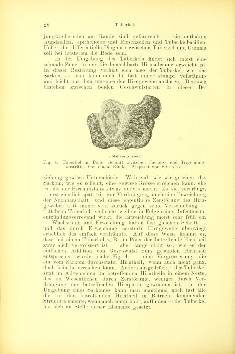 jungwucliernden am Rande sind gefassreich — sie enthalten R-undzellen, epitlielioide und Riesenzellen und Tuberkelbacillen. Ueber die differ en tielle Diagnose zwischen Tuberkel und Gumma soil bei letzterem die Rede sein. In der Umgebung des Tuberkels findet sich meist eine schmale Zone, in der die benachbarte Hirnsubstanz erweiclit ist. In dieser Beziehung verhalt sich also der Tuberkel wie das Sarkom -— man kann audi ihn fast immer stumpf vollstandig und leicht aus dem umgebenden Hirngewebe auslosen. Dennoch bestehen zwischen beiden Geschwulstarten in dieser Be- 2 Mai vergrossert. Fig. 4. Tuberkel im Pons. Scbnitt zwischen Facialis- und Trigeminus- austritt. Von einem Kinde. Praparat von Strobe. ziehung gewisse Unterschiede. Wahrend, wie wir gesehen. das Sarkom, wie es scheint, eine gewisse Grosse erreichen kann. ehe es mit der Hirnsubstanz etwas anders macht, als sie verdrangt, — erst ziemlich spat tritt zur Verdrangung auch eine Erweichung der Nachbarschaft, und diese eigentliche Zerstorung des Hirn- gewebes tritt immer sehr zuriick gegen seine Yerschiebung — tritt beim Tuberkel, vielleicht weil er in Folge seiner Infectiositat entzundungserregend wirkt, die Erweichung meist sehr friih ein - Wachsthum und Erweichung halten fast gleichen Schritt — und das durch Erweichung zerstorte Hirngewebe iiberwiegt erheblich das einfach verdrangte. Auf diese Weise kommt es, dass bei einem Tuberkel z. B. im Pons der betreffende Hirntheil zwar auch vergrossert ist — aber lange nicht so, wie es der einfachen Addition von Geschwulst zum gesunden Hirntheil entsprechen wiirde (siehe Fig. 4) — eine Yeigrosserung, die ein vom Sarkom durchsetzter Hirntheil, wenn auch nicht ganz, doch beinahe erreichen kann. Anders ausgedriickt: der Tuberkel sitzt im Allgemeinen im betreffenden Hirntheile in einem Neste, das im Wesentlichen durch Zerstorunp-, wenioer durch Yer- drangung der betreffenden Hirnpartie gewonnen ist; in der Umgebung eines Sarkomes kann man manchmal noch fast alle die fur den betreffenden Hirntheil in Betracht kommenden Structurelemente, wenn auch comprimirt, auffinden — der Tuberkel hat sich an Stelle dieser Elemente gesetzt.