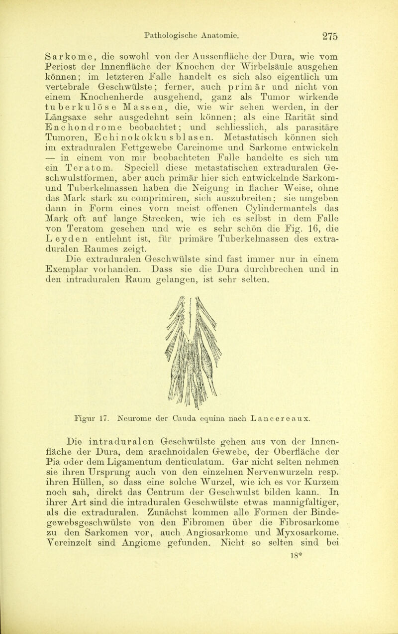 Sarkome, die sowohl von der AussenfLache der Dura, wie vom Periost der Innenflache der Knochen der Wirbelsaule ausgehen konnen; im letzteren Falle handelt es sich also eigentlich am vertebrale Geschwiilste; ferner, auch prim ar und nicht von einem Knochenherde ausgehend, ganz als Tumor wirkende tuberkulose lassen, die, wie wir sehen werden, in der Langsaxe sehr ausgedehnt sein konnen; als eine Raritat sind Encliondrome beobachtet; und schliesslich, als parasitare Tumoren, Echi nokokku s bl asen. Metastatisch konnen sich im extraduralen Fettgewebe Carcinome und Sarkome entwickeln — in einem von mir beobachteten Falle handeite es sich um ein Teratom. Speciell diese metastatisch en extraduralen Ge- schwulstformen, aber auch primar hier sich entwickelnde Sarkom- und Tuberkelmassen haben die Neigung in nacher Weise, ohne das Mark stark zu comprimiren, sich auszubreiten; sie umgeben dann in Form eines vorn meist offenen Cylindermantels das Mark oft auf lange Strecken, wie ich es selbst in dem Falle von Teratom gesehen und wie es sehr schon die Fig. 16, die Leyden entlehnt ist, fur primare Tuberkelmassen des extra- duralen Raumes zeigt. Die extraduralen Geschwiilste sind fast immer nur in einem Exemplar vorhanden. Dass sie die Dura durchbrechen und in den intradural en Raum gelangen, ist sehr selten. Fignr 17. Neurome der Cauda equina nach Lancereaux. Die intraduralen Geschwiilste gehen aus von der Innen- flache der Dura, dem arachnoidalen Gewebe, der OberfLache der Pia oder dem Ligamentum denticulatum. Gar nicht selten nehmen sie ihren Ursprung auch von den einzelnen Nervenwurzeln resp. ihren Hiillen, so dass eine solche Wurzel, wie ich es vor Kurzem noch sah, direkt das Centrum der Geschwulst bilden kann. In ihrer Art sind die intraduralen Geschwiilste etwas mannigfaltiger, als die extraduralen. Zunachst kommen alle Formen der Binde- gewebsgeschwiilste von den Fibromen iiber die Fibrosarkome zu den Sarkomen vor, auch Augiosarkome und Myxosarkome. Yereinzelt sind Angiome gefunden. Nicht so selten sind bei 18*