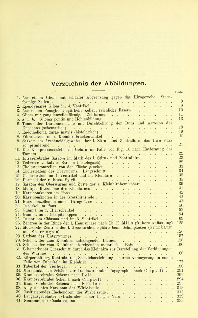 Verzeiehnis der Abbildungen. Seite 1. Aus einem Gliom mit scharfer Abgrenzung gegen das Hirngewebe. Stern- formige Zellen 9 2. Epecdymares Gliom im 4. Ventrikel 9 3. Aus einem Ponsgliom; sparlicbe Zellen, reicbliche Fasern 10 4. Gliom mit ganglienzellenformigen Zellformen 11 5. a u. b. Glioma pontis mit Hohlenbildung . . . 13 6. Tumor der Durainnenflache mit Durchbohrung der Dura und Arrosion des Knocbens (scbematiscb) 19 7. Endothelioma durae matris (histologisch) 19 8. Fibrosarkom im r. Kleinhirnbriickenwinkel 20 9. Sarkom im Aracbnoidalgewebe iiber 1. Stirn- und Zentralhirn, das Hirn stark komprimierend 21 10. Die Kompressionsstelle im Gebirn im Falle von Fig. 10 nacb Eutfernung des Tumors 22 11. Intrazerebraies Sarkom im Mark des 1. Stirn- und Zentralhirns 23 12. Teilweise verkalktes Sarkom (histologisch) 28 13. Cholesteatomzellen von der Flache gesehen 33 14. Cholesteatom des Oberwurms. Langsschnitt 34 15. Cholesteatom im 4. Ventrikel und im Kleinhirn 35 16. Dermoid der r. Fossa Sylvii 35 17. Sarkom des Oberwurms und Zyste der r. Kleinhirnhemisphare 39 18. Multiple Karzinome des Kleinhirnes 41 19. Karzinomknoten im Pons 42 20. Karzinomknoten in der Grossbirnrinde 42 21. Karzinomzellen in einem Hirngefasse 43 22. Tuberkel im Pons 50 23. Gumma im r. Hirnschenkel 52 24. Gumma im 1. Okzipitallappen 54 25. Tumor am Chiasma und im 3. Ventrikel 69 26. Zentren in der Rinde der 1. Hemisphere nach Ch. K. Mills (fnihere Auffassung) 125 27. Motorische Zentren der 1. Grosshirnhemisphare beim Schimpansen (Griinbaum und Sherrington) 126 28. Sarkom des Unterwurmes 157 29. Schema der zum Kleinhirn aufsteigenden Bahnen 158 30. Schema der vom Kleinhirn absteigenden motorischen Babnen 160 31. Schematischer Querschnitt durch das Kleinhirn zur Darstellung der Verbindungen des Wurmes 166 32. Korperhaltung, Kontrakturen, Schadelausdehnung, enorme Abmagerung in einem Falle von Tuberkeln im Kleinhirn 177 33. Tuberkel der Vierhugel 188 34. Merkpunkte am Schadel zur kraniozerebralen Topographie nach Chipault . . 291 35. Kraniozerebrales Schema nach Reid 292 36. Kraniozerebrales Schema nach Chipault 294 37. Kraniozerebrales Schema nach Kronlein 295 38. Ausgedehntes Karzinom der Wirbelsaule 313 39. Ossifizierendes Enchondrom der Wirbelsaule . . 315 40. Langausgedehnter extraduraler Tumor kasiger Natur 332 41. Neurome der Cauda equina 333