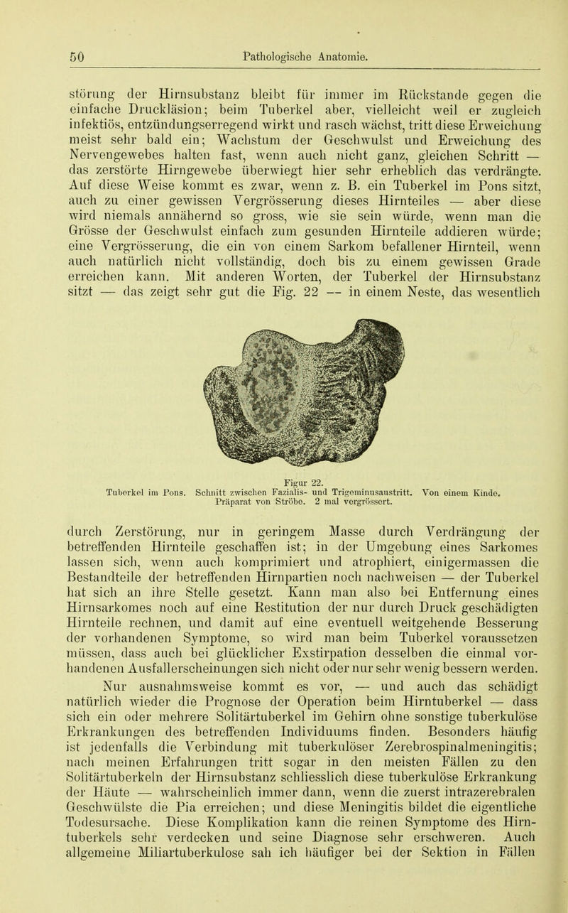 stoning der Hirnsubstanz bleibt fur immer im Riickstande gegen die einfache Drucklasion; beira Tuberkel aber, vielleicht weil er zugieieh infektios, entziindungserregend wirkt und rasch wachst, tritt diese Erweichung meist sehr bald ein; Wacbstum der Geschwulst und Erweichung des Nervengewebes halten fast, wenn auch nicht ganz, gleichen Schritt — das zerstorte Hirngewebe iiberwiegt hier sehr erheblich das verdrangte. Auf diese Weise koramt es zwar, wenn z. B. ein Tuberkel im Pons sitzt, auch zu einer gewissen Vergrosserung dieses Hirnteiles — aber diese wird niemals annahernd so gross, wie sie sein wiirde, wenn man die Grosse der Geschwulst einfach zum gesunden Hirnteile addieren wiirde; eine Vergrosserung, die ein von einem Sarkom befallener Hirnteil, wenn auch natiirlich nicht vollstandig, doch bis zu einem gewissen Grade erreichen kann. Mit anderen Worten, der Tuberkel der Hirnsubstanz sitzt — das zeigt sehr gut die Fig. 22 — in einem Neste, das wesentlich Figur 22. Tuberkel im Pons. Schnitt zwischen Fazialis- und Trigeminusaustritt. Von einem Kinde. Praparat von Strobe. 2 mal vergrossert. durch Zerstorung, nur in geringem Masse durch Verdrangung der betreffenden Hirnteile geschaffen ist; in der Umgebung eines Sarkomes lassen sich, wenn auch komprimiert und atrophiert, einigermassen die Bestandteile der betreffenden Hirnpartien noch nachweisen — der Tuberkel hat sich an ihre Stelle gesetzt. Kann man also bei Entfernung eines Hirnsarkomes noch auf eine Restitution der nur durch Druck geschadigten Hirnteile rechnen, und damit auf eine eventuell weitgehende Besserung der vorhandenen Symptome, so wird man beim Tuberkel voraussetzen mussen, dass auch bei gliicklicher Exstirpation desselben die einmal vor- handenen Ausfallerscheinungen sich nicht oder nur sehr wenig bessern werden. Nur ausnahmsweise kommt es vor, — und auch das schadigt natiirlich wieder die Prognose der Operation beim Hirntuberkel — dass sich ein oder mehrere Solitartuberkel im Gehirn ohne sonstige tuberkulose Erkrankungen des betreffenden Individuums finden. Besonders haufig ist jedenfalls die Verbindung mit tuberkuloser Zerebrospinalmeningitis; nach meinen Erfahrungen tritt sogar in den meisten Fallen zu den Solitartuberkeln der Hirnsubstanz schliesslich diese tuberkulose Erkrankung der Haute — wahrscheinlich immer dann, wenn die zuerst intrazerebralen Geschwiilste die Pia erreichen; und diese Meningitis bildet die eigentliche Todesursache. Diese Komplikation kann die reinen Symptome des Hirn- tuberkels sehr verdecken und seine Diagnose sehr erschweren. Auch allgemeine Miliartuberkulose sah ich liaufiger bei der Sektion in Fallen
