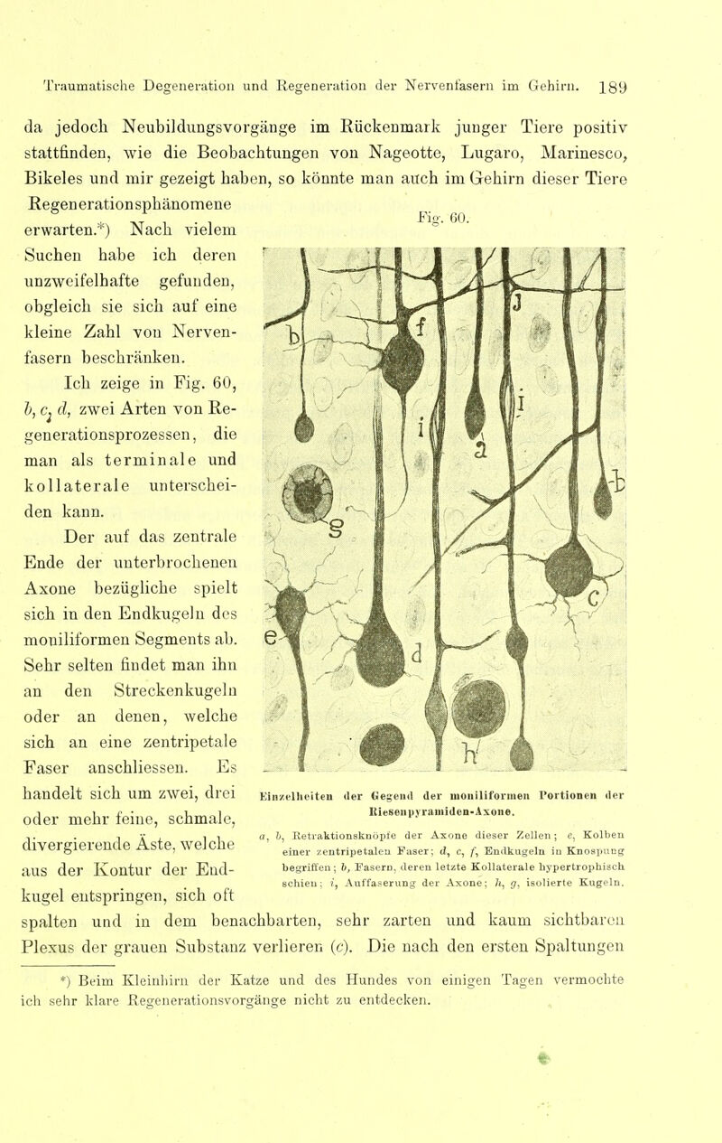 Fig. 60. da jedoch Neubildungsvorgange im Riickenmark junger Tiere positiv stattfinden, wie die Beobachtungen von Nageottc, Lugaro, Marinesco, Bikeles und mir gezeigt kaben, so konnte man auch im Gehirn dieser Tiere Regenerationsphanomene erwarten.*) Nach vielem Suchen habe ich deren unzwcifelhafte gefunden, obgleich sie sich auf eine kleine Zahl you Nerven- fasern beschranken. Ich zeige in Fig. 60, b, ci d, zwei Arten von Re- generationsprozessen, die man als terminale und kollaterale untersckei- den kann. Der auf das zentrale Ende der unterbrochenen Axone beziigliche spielt sich in den Endkugeln des moniliformen Segments ab. Sehr selten findet man ihn an den Streckenkugeln oder an denen, welche sich an eine zentripetale Faser anschliessen. Es handelt sich um zwei, drei oder mehr feine, schmale, divergierende Aste, welche aus der Kontur der End- kugel eutspringen, sich oft spalten und in dem benachbarten, sehr zarten und kaum sichtbarcn Plexus der grauen Substanz verlieren (c). Die nach den ersten Spaltungen Ein/ellieiteu der Gegend der nioniliformen I'ortionen der Kiesen pyrainiden- Axone. a, J), Retraktionskuopie der Axone dieser Zellen; e, Kolben einer zentripetaleu Faser; <J, c, f, Endkugeln in Knospucg begrift'en ; 6, Fasern, deren letzte Kollaterale bypertropbisch. schien: ?, Auffaserung der Axone; 7i, g, isolierte Kugeln. *) Beim Kleinhirn der Katze und des Hundes von einigen Tagen vermochte ich sehr klare Regenerationsvorgange nicht zu entdecken.
