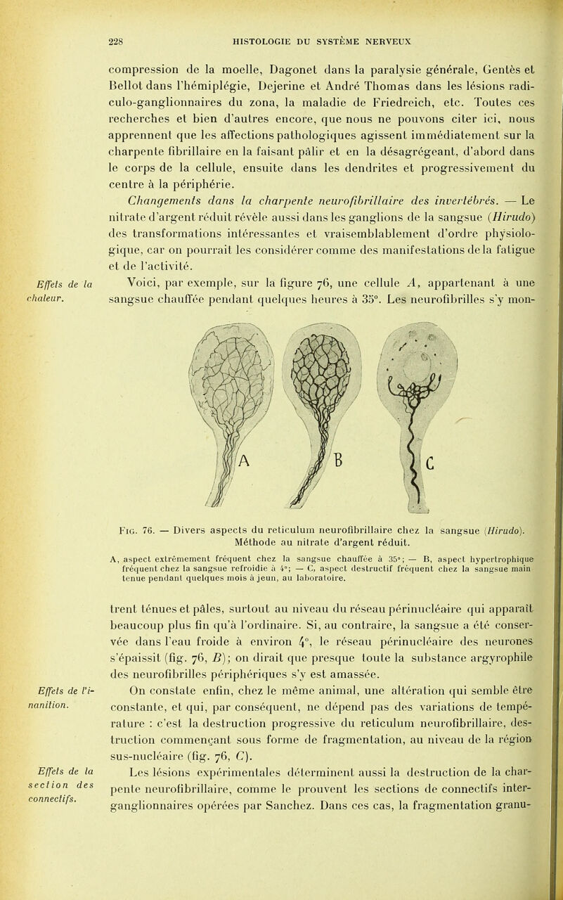 compression de la moelle, Dagonet dans la paralysie generale, Gentes et Bellot dans l'hemipl£gie, Dejerine et Andre Thomas dans les lesions radi- culo-ganglionnaires du zona, la maladie de Friedreich, etc. Toutes ces recherches et bien d'autres encore, que nous ne pouvons citer ici, nous apprennent que les affections pathologiques agissent immediatement sur la charpente fibrillaire en la faisant palir et en la desagregeant, d'abord dans le corps de la cellule, ensuite dans les dendrites et progressivement du centre a la pe>iph6rie. Changements dans la charpente neurofibrillaire des invertebres. — Le nitrate d'argent reduit revele aussi dans les ganglions de la sangsue (Hirudo) des transformations interessantes et vraisernblablement d'ordre physiolo- gique, car on pourrait les considerer comme des manifestations de la fatigue et de l'activite. Effets de la Voici, par exemple, sur la figure 76, une cellule A, appartenant a une chaleur. sangsue chauffee pendant quelques heures a 35°. Les neurofibrilles s'y mon- Fig. 76. — Divers aspects du reticulum neurofibrillaire chez la sangsue {Hirudo). Methode au nitrate d'argent reduit. A, aspect extremement frequent chez la sangsue chauffee a 35°; — B, aspect hypertrophique frequent chez la sangsue refroidie a 4°; — C, aspect destructif frequent chez la sangsue main tenue pendant quelques mois a jeun, au laboraloire. trent tenues et pales, surtout au niveau du reseau perinucleaire qui apparatt beaucoup plus fin qu'a l'ordinaire. Si, au contraire, la sangsue a 6te conser- \6e dans l'eau froide a environ 4°i le reseau perinucleaire des neurones s'6paissit (fig. 76, B); on dirait que presque toute la substance argyrophile des neurofibrilles peripheriques s'y est amassee. Effets de I'i- On constate enfin, chez le meme animal, une alteration qui semble etre nanition. constante, et qui, par consequent, ne depend pas des variations de tempe- rature : c'est la destruction progressive du reticulum neurofibrillaire, des- truction commenyant sous forme de fragmentation, au niveau de la region sus-nucleaire (fig. 76, C). Effets de la Les lesions experimentales d6terminent aussi la destruction de la char- pente neurofibrillaire, comme le prouvent les sections de connectifs inter- ganglionnaires operees par Sanchez. Dans ces cas, la fragmentation granu- section des connectifs