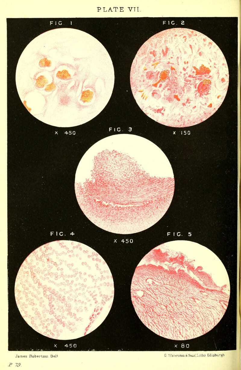 PLATE VTI. FIG. 1 - FIC. 2 James Robertson DeU G '//aterston & Soiis.Litho Edinburgh