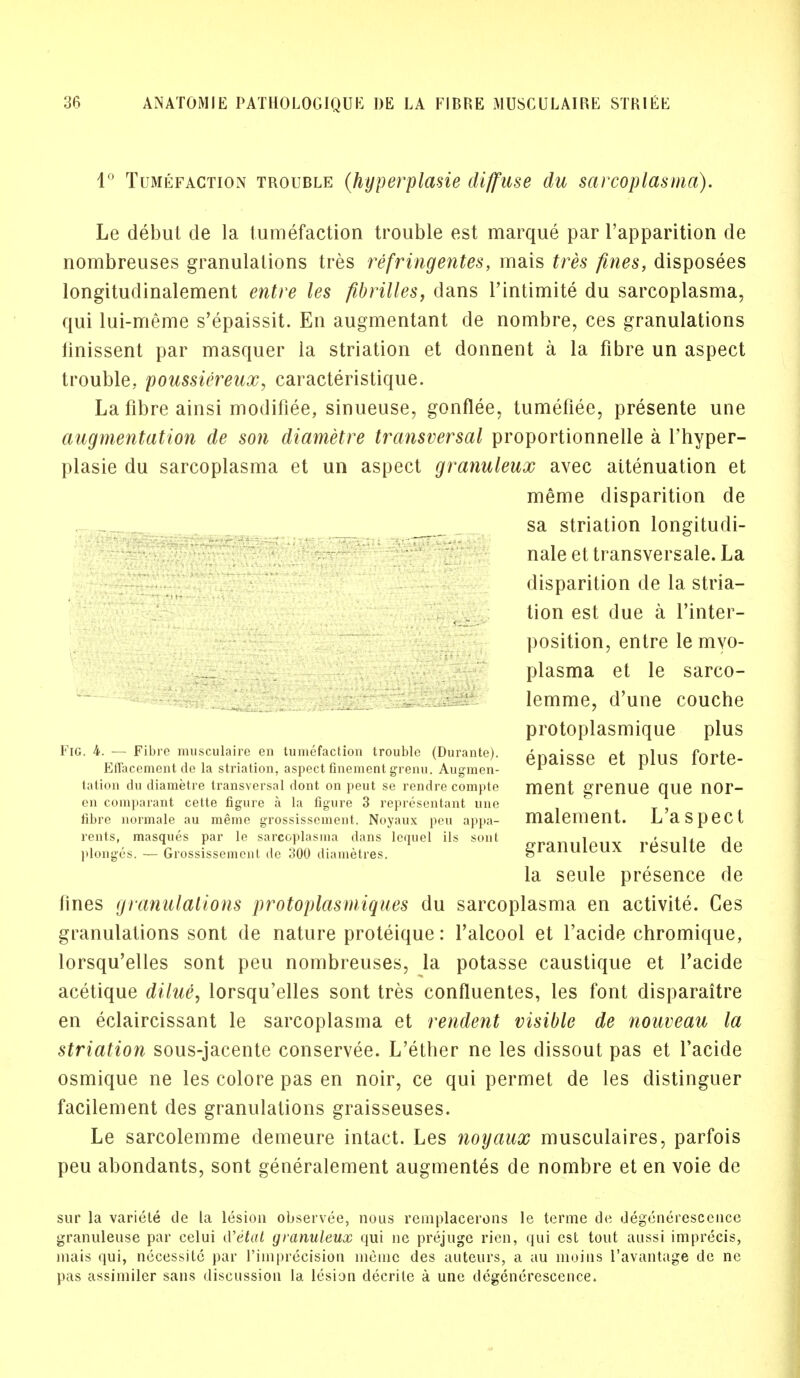 1° Tumefaction trouble (hyperplasie diffuse du sarcoplasma). Le debut de la tumefaction trouble est marque par l'apparition de nombreuses granulations tres refringentes, mais tres fines, disposees longitudinalement entre les fibrilles, dans l'intimite du sarcoplasma, qui lui-meme s'epaissit. En augmentant de nombre, ces granulations linissent par masquer la striation et donnent a la fibre un aspect trouble, poussiereux, caracteristique. La fibre ainsi modifiee, sinueuse, gonflee, tumefiee, presente une augmentation de son diametre transversal proportionnelle a l'hyper- plasie du sarcoplasma et un aspect granuleux avec attenuation et meme disparition de sa striation longitudi- nale et transversale. La disparition de la stria- tion est due a l'inter- position, entre le myo- plasma et le sarco- lemme, d'une couche protoplasmique plus epaisse et plus forte- ment grenue que nor- malement. L'aspect granuleux resulte de la seule presence de lines granulations protoplasmiques du sarcoplasma en activite. Ces granulations sont de nature proteique: l'alcool et l'acide chromique, lorsqu'elles sont peu nombreuses, la potasse caustique et Tacide acetique dilue, lorsqu'elles sont tres confluentes, les font disparaitre en eclaircissant le sarcoplasma et rendent visible de nouveau la striation sous-jacente conservee. L'ether ne les dissout pas et l'acide osmique ne les colore pas en noir, ce qui permet de les distinguer facilement des granulations graisseuses. Le sarcolemme demeure intact. Les noyaux musculaires, parfois peu abondants, sont generalement augmentes de nombre et en voie de sur la variete de la lesion observee, nous remplacerons le terme de degenerescence granuleuse par eelui d'etat granuleux qui ne prejugc rien, qui est tout aussi imprecis, mais qui, necessite par rimprecision meme des auteurs, a au moins l'avantage de ne pas assiiniler sans discussion la lesion decrite a une degenerescence. Fig. 4. — Fibre musculaire en tumefaction trouble (Durante). EiTacement de la striation, aspect fmement grenu. Augmen- tation du diametre transversal dont on peut se rendre compte en comparant cette figure a la figure 3 representant une fibre normale au meme grossissement. Noyaux peu appa- rents, masques par le sarcoplasma dans lequel ils sont plonges. — Grossissement de 300 diametres.