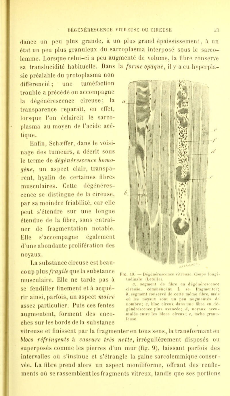 dance un peu plus grande, a un plus grand epaississement, a un etat un peu plus granuleux du sarcoplasma interpose sous le sarco- lemme. Lorsque celui-ci a peu augmente de volume, la fibre conserve sa translucidite hahiluelle. Dans la forme opaque, ily a eu hyperpla- sie prealable du protoplasma non difference; une tumefaction trouble a precede ou accompagne la degenerescence cireuse; la transparence reparait, en effet. lorsque Ton eclaircit le sarco- plasma au moyen de I'acide ace- tique. Enfin, Sch«re(Ter, dans le voisi- nage des tumeurs, a decrit sous le terme de degenercuninc homo- gene, un aspect clair, transpa- rent, byalin de certaines fibres musculaires. Cette degeneres- cence se distingue de la cireuse, par sa moindre friability car elle peut s'etendre sur une longue etendue de la libre, sans entral- ner de fragmentation notable. Kile s'aceompagne e^alement d'une abondante proliferation des noyaux. La substance cireuse estbeau- coup plus fragileque\& substance musculaire. Elle ne tarde pas a se fendiller linement et a aeque- rir ainsi, parfois, un aspect mou <■ assez particulier. Puis ces fentes augmentent, torment des enco- cbes sur les bonis de La substance vitreuse et finissent par la fragmenteren toussens,la transformanten blocs rtfringents a (-assure tri's nette, irregulierement disposes ou superposes comme les pierres d'un mur (fig. 9), laissant parfois des intervalles ou s'insinue et s'etrangle la gaine sarcolemmique conser- ved. La libre prend alors un aspect moniliforme, offrant des renfle- inents ou se rassemblent les fragments vitreux. tandis que ses portions  ■ —— ' '' i * »'• ■ I >t. t t 1 * 1 P ■ 'ji'i If u 1 • *# 1;. ' Fic. io. — n<-t ii<:i»•> ludinale (Letulle) a. segment d •uce vitreuse. Coupe longi- fibre en d6grin6rescence cireuse, comiiieii<;.int h se fragmentcr; b. segment conserve de cetle me me. libre, mais ou les noyaux sont un peu augmented de nombre; c, l)loc cireux dans une libre en de- geoO'reBcence plus avancee; d, noyaux accu- inii 16s enlre les blocs cireux; c, tache granu- leuse.