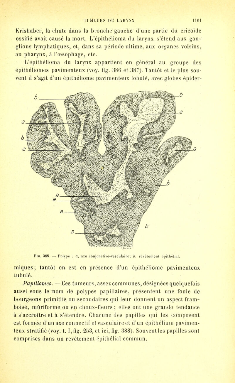 Krishaber, la chute dans la bmnche gauche d'une partie du cricoidc ossifie avail cause la mort. L'epithelioma du larynx s'etend aux gan- glions lymphatiques, el, dans sa periode ullime, aux organes voisins, au pharynx, a I'oesophage, elc. L'epithelioma du larynx appartient en general au groupe des epilheliomes pavimenleux (voy. fig. 386 el 387). Tantol el le plus sou- vent il s'agil d'un epilheliome pavimenleux lobule, avec globes epider- FlG. .388. — Polype : a, axe conjonclivo-vasculairc; b, reveleincnt epithelial. miques; lantot on est en presence d'un epitheliome pavimenleux lubule. Papillomes. — Ges tumeurs, asscz communes, designees quelquefois aussi sous le nom de polypes papillaires, presentent une foule de bourgeons primilifs ou secondaires qui leur donnent un aspect fram- boise, muriforme ou en choux-fleurs ; elles onl une grande lendance a s'accroilre el a s'etendre. Ghacunc des papilles qui les composenl est formee d'un axe connectif el vasculaireet d'un epiUielium pavimen- leux stralifie (voy. 1.1, fig. 253, ct ici, fig. 388). Souvenl les papilles sonl comprises dans un revetcmenl epithelial commun.