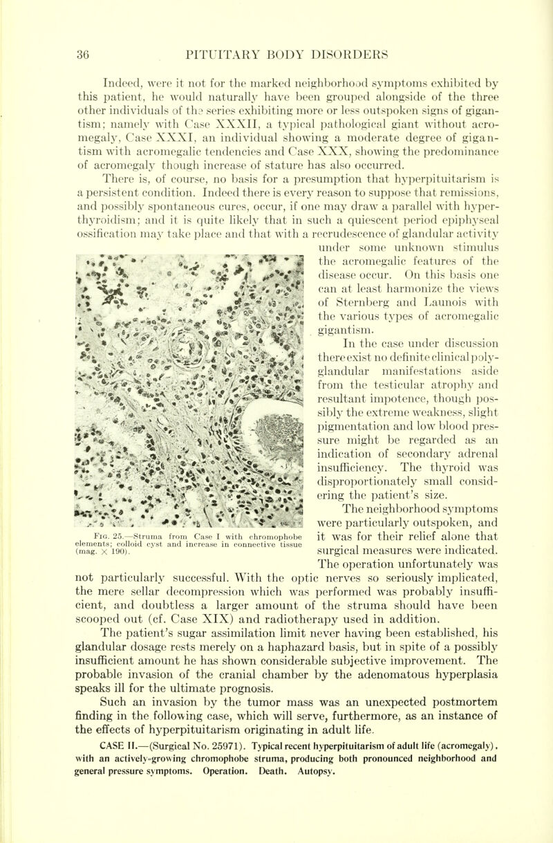 Indeed, were it not for the marked neighborhood S3'niptoms exhibitetl by this patient, he would naturall\^ have been grouped alongside of the three other individuals of the series exhibiting more or less outspoken signs of gigan- tism; namely with Case XXXII, a typical pathological giant without acro- megaly, Case XXXI, an individual showing a moderate degree of gigan- tism with acromegalic tendencies and Case XXX, showing the predominance of acromegaly though increase of stature has also occurred. There is, of course, no basis for a presumption that hyperpituitarism is a persistent condition. Indeed there is every reason to suppose that remissions, and possibly spontaneous cures, occur, if one may draw a parallel with h^'per- thyroidism; and it is quite likely that in such a quiescent period epiph3'seal ossification may take place and that with a recrudescence of glandular activity under some unknown stimulus the acromegalic features of the disease occur. On this basis one can at least harmonize the views of Sternberg and Launois with the various types of acromegalic gigantism. In the case under discussion there exist no definite clinical poly- glandular manifestations aside from the testicular atrophy and resultant impotence, though pos- sibly the extreme weakness, slight pigmentation and low blood pres- sure might be regarded as an indication of secondary adrenal insuflSciency. The thyroid was disproportionately small consid- ering the patient's size. The neighborhood symptoms were particularly outspoken, and it was for their relief alone that surgical measures were indicated. The operation unfortunately was not particularly successful. With the optic nerves so seriously implicated, the mere sellar decompression which was performed was probably insuffi- cient, and doubtless a larger amount of the struma should have been scooped out (cf. Case XIX) and radiotherapy used in addition. The patient's sugar assimilation limit never having been established, his glandular dosage rests merely on a haphazard basis, but in spite of a possibly insufl&cient amount he has shown considerable subjective improvement. The probable invasion of the cranial chamber by the adenomatous hyperplasia speaks ill for the ultimate prognosis. Such an invasion by the tumor mass was an unexpected postmortem finding in the following case, which will serve, furthermore, as an instance of the effects of hyperpituitarism originating in adult life. CASE II.—(Surgical No. 25971). Typical recent hyperpituitarism of adult life (acromegaly), with an actively=growing chromophobe struma, producing both pronounced neighborhood and general pressure symptoms. Operation. Death. Autopsy. - -: ' , : .i \ • . - ■ Fig. 25.—Struma from Case I with chromophobe elements; colloid cyst and increase in connective tissue (mag. X 190).