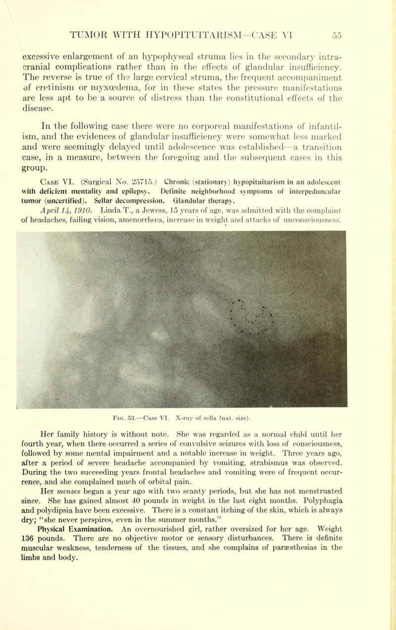 excessive enlargement of an hypophyseal struma lies in the secondary intra- cranial complications rather than in the effects of glandular insufficiency. The reverse is true of the large cervical struma, the frequent accompaniment of cretinism or myxoedema, for in these states the pressure manifestations are less apt to be a source of distress than the constitutional effects of the disease. In the following case there were no corporeal manifestations of infantil- ism, and the evidences of glandular insufficiency were somewhat less marked and were seemingly delayed until adolescence was established—a transition case, in a measure, between the foregoing and the subsequent cases in this group. Case VI. (Surgical No. 25715.) Chronic (stationary) hypopituitarism in an adolescent with deficient mentality and epilepsy. Definite neighborhood symptoms of interpeduncular tumor (uncertified). Sellar decompression. Glandular therapy. April 14, 1910. Linda T., a Jewess, 15 years of age, was admitted with the complaint of headaches, failing vision, amenorrhoea, increase in weight and attacks of unconsciousness. Fig. 53.—Case VI. X-ray of sella (nat. size). Her family history is without note. She was regarded as a normal child until her fourth year, when there occurred a series of convulsive seizures with loss of consciousness, followed by some mental impairment and a notable increase in weight. Three years ago, after a period of severe headache accompanied by vomiting, strabismus was observed. During the two succeeding years frontal headaches and vomiting were of frequent occur- rence, and she complained much of orbital pain. Her menses began a year ago with two scanty periods, but she has not menstruated since. She has gained almost 40 pounds in weight in the last eight months. Polyphagia and polydipsia have been excessive. There is a constant itching of the skin, which is always dry; she never perspires, even in the summer months. Physical Examination. An overnourished girl, rather oversized for her age. Weight 136 pounds. There are no objective motor or sensory disturbances. There is definite muscular weakness, tenderness of the tissues, and she complains of paraesthesias in the limbs and body.