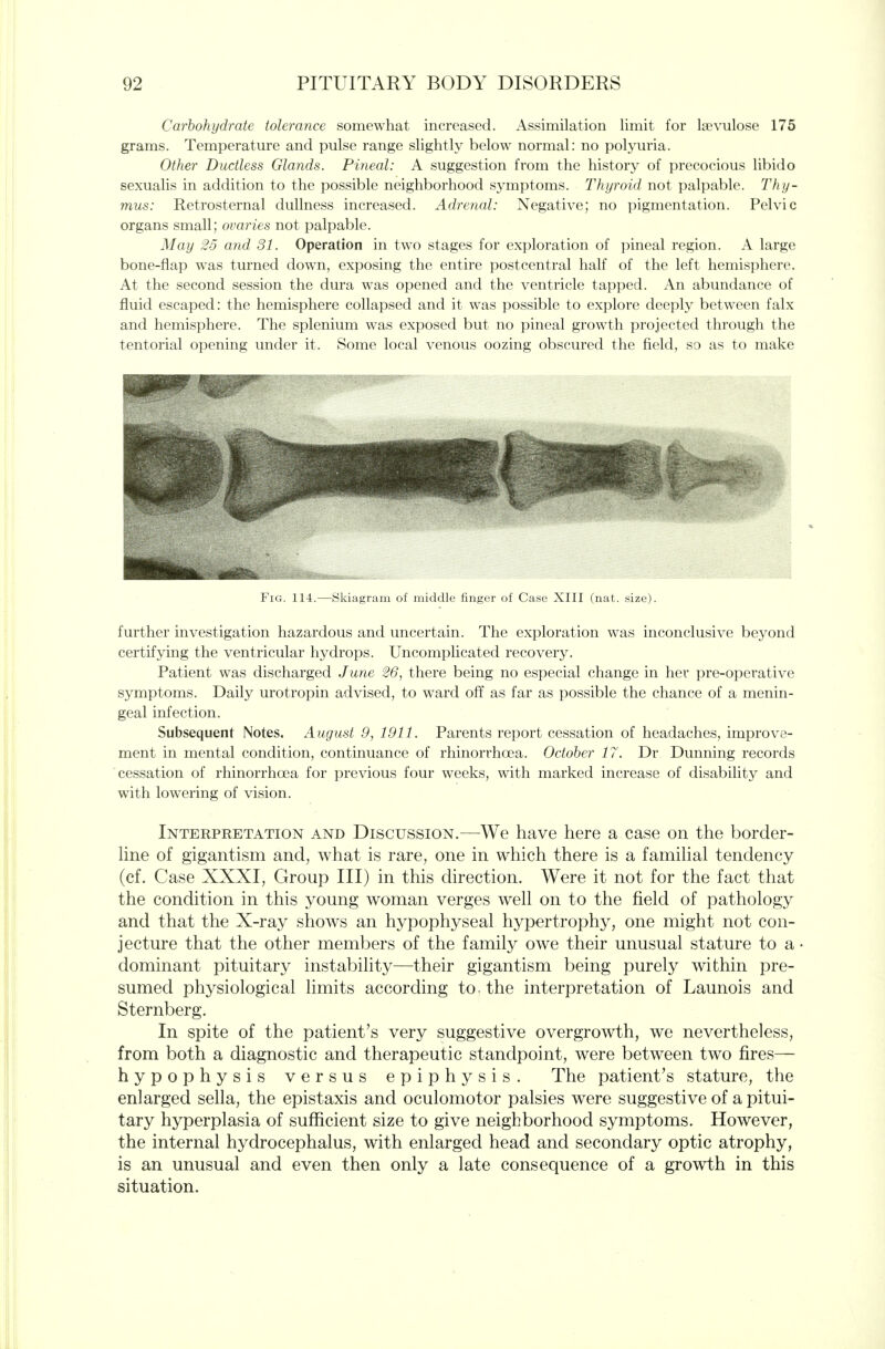Carbohydrate tolerance somewhat increased. Assimilation limit for Isevulose 175 grams. Temperature and pulse range slightly below normal: no polyuria. Other Ductless Glands. Pineal: A suggestion from the history' of i)recoeious libido sexualis in addition to the possible neighborhood symptoms. Thyroid not palpable. Thy- mus: Retrosternal dullness increased. Adrenal: Negative; no pigmentation. Pelvic organs small; ovaries not palpable. May 25 and 31. Operation in two stages for exploration of pineal region. A large bone-flap was turned down, exposing the entire postcentral half of the left hemisphere. At the second session the dura was opened and the ventricle tapped. An abundance of fluid escaped: the hemisphere collapsed and it was possible to explore deeply between falx and hemisphere. The splenium was exposed but no pineal growth projected through the tentorial opening under it. Some local venous oozing obscured the field, so as to make Fig. 114.—Skiagram of middle finger of Case XIII (nat. size). further investigation hazardous and uncertain. The exploration was inconclusive beyond certifying the ventricular hydrops. Uncomplicated recovery. Patient was discharged June 26, there being no especial change in her pre-operative symptoms. Daily urotropin advised, to ward off as far as possible the chance of a menin- geal infection. Subsequent Notes. August 9, 1911. Parents report cessation of headaches, improve- ment in mental condition, continuance of rhinorrhoea. October 17. Dr Dunning records cessation of rhinorrhoea for previous four weeks, with marked increase of disability and with lowering of vision. Interpretation and Discussion.—We have here a case on the border- Hne of gigantism and, what is rare, one in which there is a famiUal tendency (cf. Case XXXI, Group III) in this direction. Were it not for the fact that the condition in this young woman verges well on to the field of pathology and that the X-ray shows an hypophyseal hypertrophy, one might not con- jecture that the other members of the family owe their unusual stature to a dominant pituitary instability—their gigantism being purely within pre- sumed physiological limits according to. the interpretation of Launois and Sternberg. In spite of the patient's very suggestive overgrowth, we nevertheless, from both a diagnostic and therapeutic standpoint, were between two fires— hypophysis versus epiphysis. The patient's stature, the enlarged sella, the epistaxis and oculomotor palsies were suggestive of a pitui- tary hyperplasia of sufficient size to give neighborhood symptoms. However, the internal hydrocephalus, with enlarged head and secondary optic atrophy, is an unusual and even then only a late consequence of a growth in this situation.