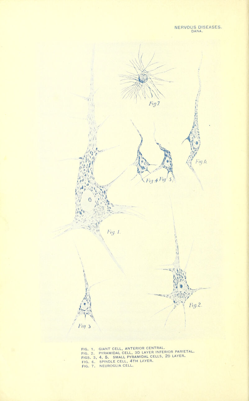 NERVOUS DISEASES, DANA, (/ / \i / A at /%. i. %2. FIG. 1. GIANT CELL, ANTERIOR CENTRAL. FIG 2 PYRAMIDAL CELL, 3D LAYER INFERIOR PARIETAL. FIGS. 3, 4, 5. SMALL PYRAMIDAL CELLS, 2D LAYER. FIG. 6.' SPINDLE CELL, 4TH LAYER. FIG. 7. NEUROGLIA CELL.