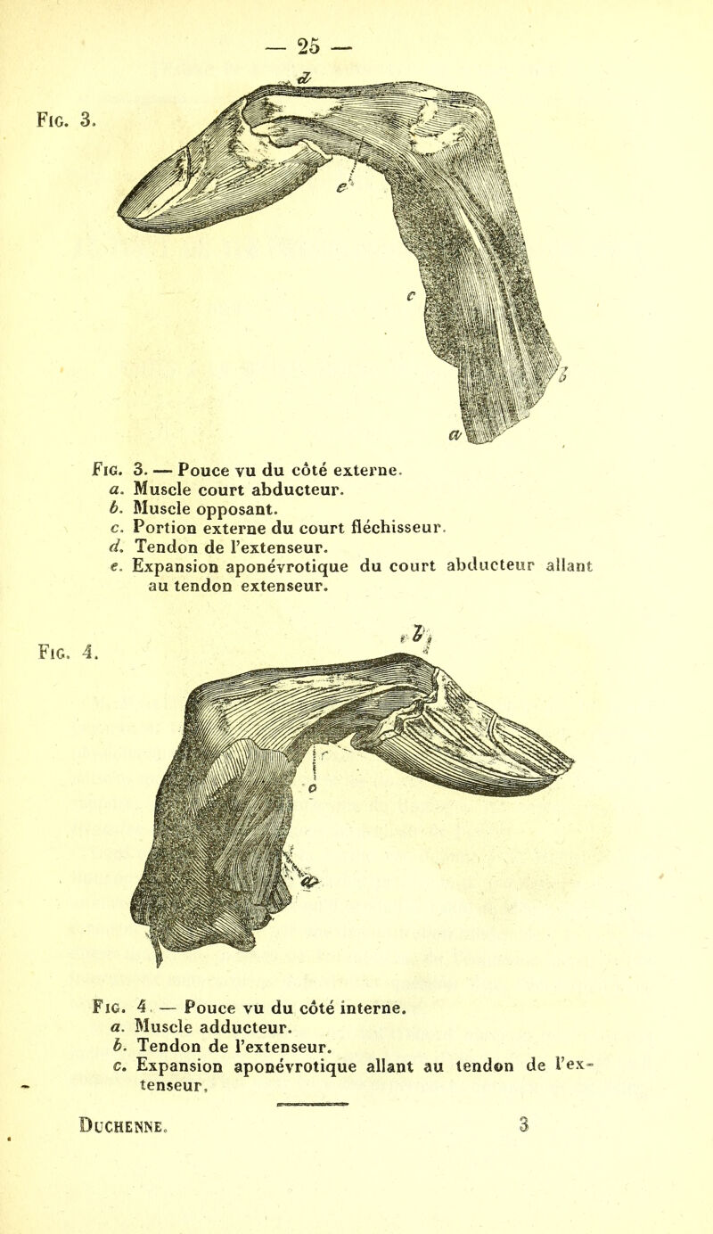 - 25 — Fig. 3. Fig. 3. — Pouce vu du cote externe. a. Muscle court abducteur. b. Muscle opposant. c. Portion externe du court flechisseur. d. Tendon de I'extenseur. e. Expansion aponevrotique du court abducteur allant au tendon extenseur. Fig. 4. Fig. 4 — Pouce vu du cote interne. a. Muscle adducteur. b. Tendon de I'extenseur. c. Expansion aponevrotique allant au tendon de I'ex- tenseur,