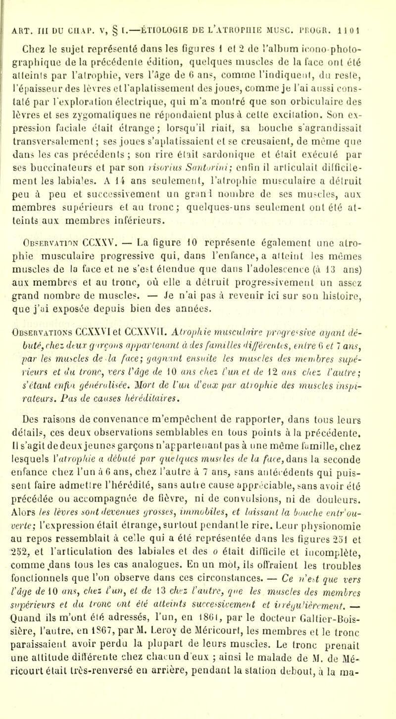 Chez le siijet repr6sent6 dans les Hgiircs \ el 2 dc ralbnm icono pholo- graphique de la prec^detile odilion, quelqiies luuscles de la lace ont et6 alteinls par I'alrophie, vers I'age de 6 an?, comrnc rindiquenl, dii rcslfe, I'^paisseur des levres etraplalissenieul des joue?, comme je I'ai aiissi cons- tats par Texploralion 61ectrique, qui m'a mon(r6 que son orbiculaire des l^ivres et ses zygomaliques ne re])Oi)daienl plus A celle cxciialion. Son ex- pression fuciale elait elrange; lorsqu'il riait, sa bouclie sagrandissait transversalement; ses joues s'aplatissaient el se creusaienf, de nncme que dans les cas precedents; son rire 6tail sardonique et elait execu(6 par ses buccinaleurs et par son risorius Santurini; en fin il arliculait dilficile- n:ient les labiates. A li ans seuiemeiit, ralroiiliie mu^culaire a delruit peu a peu et succc^ssivemeut un gr.ml nouibre de ses muHles, aux nciembres superieurs et au trouc; quelques-uns seulement out etc at- leints aux membres infericurs. Observation CCXW. — I.a figure 10 reprSsenle Sgalenient une atro- phie musculaire progressive qui, dans renfance,a aiteint les momes muscles de la face et ne s'e^t Slendue que dans I'adolescence (a 13 ans) aux membres et au tronc, ou elle a detiuit progres.>ivemetit un asscz grand nombre de muscle?. — Je n'ai pas a reveuir ici sur son histoire, que j'ui exposL^e depuis bien des annees. Observations CCXXVIet CCXXVII. Atropkie musculnire progressive ayant de- bute, chez dtUT g ircoiis apparlenunt d des families di/fercnks, enlre G et 7 ans^ par les muscles de la face; yagnant ensuite les muscles des mernbres supe- rieurs et da tronr^ vers Vage de 10 ans chez fwi et de 12 a?is chez Vautre; s'etant enfta yenertdUee. Mori de Van d'eax par atiophie des 7nuscles inspi- rateurs. Pas de causes hereditaires. Des raisons de convenance m'empOchent de rapporler, dans tous leurs detail?, ces deuv observations semblables en tous points a la precedente. II s'agit dedeux jeunc? gargons n'appartenant pas a une meme lumille, chez lesquels Witrophie a debute par quelqucs musdes de la /are, dans la seconde enfance chez I'un a 6 ans, chez I'autre a 7 ans, sans antecedents qui puis- sent faire admetlre Thercidile, sans autre cause apprtciable, sans avoir ele precedee ou accompagnce de fi^jvre, ni de convulsions, ni de doulcurs. Alors les levres sont devenues yrosses, immobiles, et laissant la bouche cntrou- oerte; I'expression etail elrange, surlout pendanlle rire. Leur physionomie au repos ressemblail a ceUe qui a ele representee dans les figures 2oI et 252, et Tarliculation des labiales el des o 6lait difficile et incomplete, comme dans tous les cas analogues. En un mot, its ofl'raient les troubles fonclionnels que Ton observe dans ces circouslances. — Ce n'cit que vers I'age de 10 anSy chez fun, et de 13 ch'/z I'autre, que les muscles des membres svperieurs et da tmic ont ele alteints successivemeht et ineyuHerement. Quand ils m'ont eH^. adresses, I'un, en 1801, par le docteur Galtier-Bois- si^re, I'autre, en 1867, par M. Leroy de M6ricourt, les membres el le tronc paraissaient avoir perdu la plupart de leurs muscles. Le tronc prenait une attitude ditlerente chez ciiacun d eux ; ainsi le malade de M. de ricourtelail IrOs-renverse en arriere, pendant la station dcbout, a la ma-