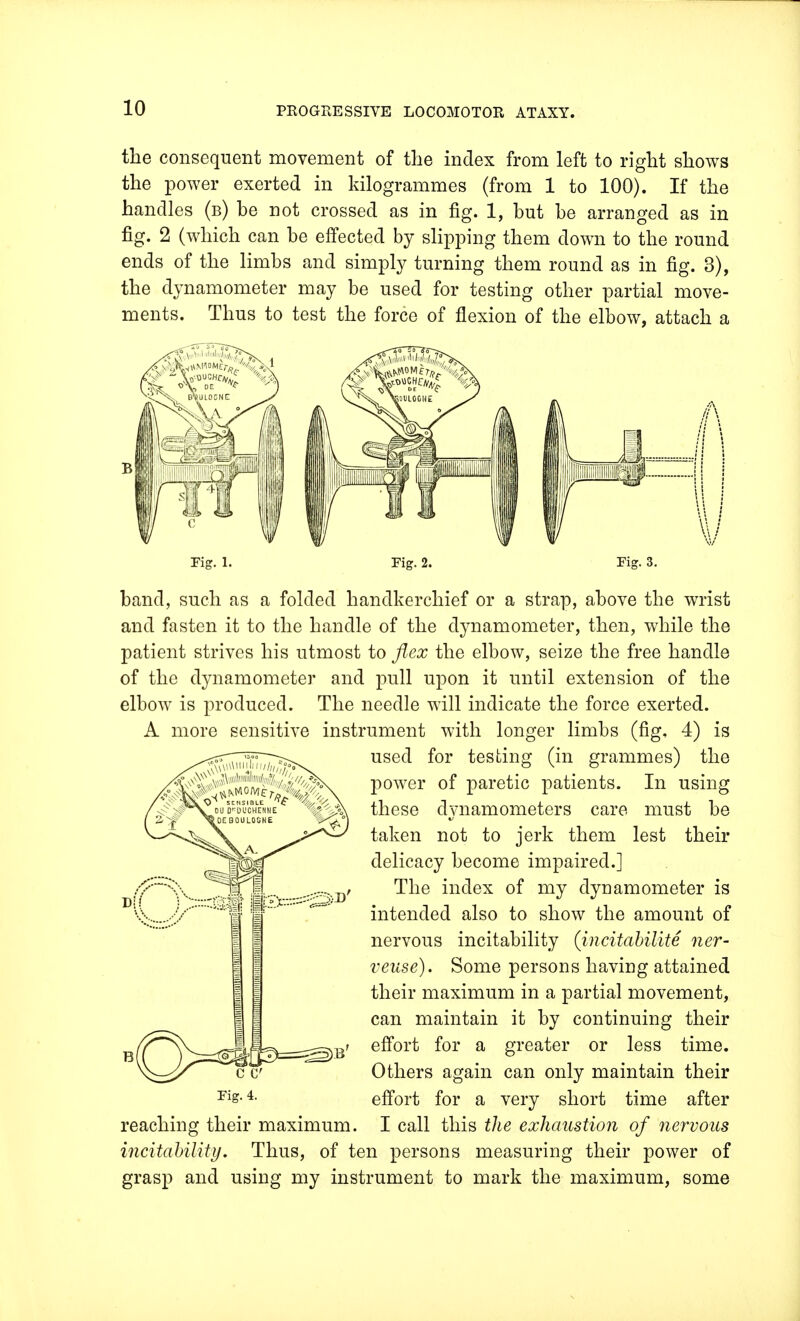 the consequent movement of the index from left to right shows the power exerted in kilogrammes (from 1 to 100). If the handles (b) be not crossed as in fig. 1, but be arranged as in fig. 2 (which can be effected by slipping them clown to the round ends of the limbs and simply turning them round as in fig. 3), the dynamometer may be used for testing other partial move- ments. Thus to test the force of flexion of the elbow, attach a Fig. 1. Fig. 2. Fig. 3. band, such as a folded handkerchief or a strap, above the wrist and fasten it to the handle of the dynamometer, then, while the patient strives his utmost to flex the elbow, seize the free handle of the dynamometer and pull upon it until extension of the elbow is produced. The needle will indicate the force exerted. A more sensitive instrument with longer limbs (fig, 4) is used for testing (in grammes) the power of paretic patients. In using these dynamometers care must be taken not to jerk them lest their delicacy become impaired.] The index of my dynamometer is intended also to show the amount of nervous incitability (incitabilite ner- veuse). Some persons having attained their maximum in a partial movement, can maintain it by continuing their effort for a greater or less time. Others again can only maintain their effort for a very short time after I call this the exhaustion of nervous incitability. Thus, of ten persons measuring their power of grasp and using my instrument to mark the maximum, some Fig. 4. reaching their maximum.