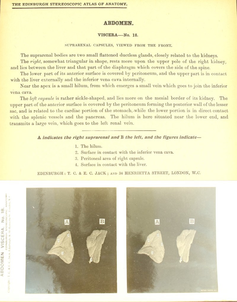The suprarenal bodies are two small flattened ductless glands, closely related to the kidneys. and lies between the liver and that part of the diaphragm which covers the side of the spine. The lower part of its anterior surface is covered by peritoneum, and the upper part is in contact with the liver externally and the inferior vena cava internally. Near the apex is a small hilum, from which emerges a small vein which goes to join the inferior vena cava. The left capsule is rather sickle-shaped, and lies more on the mesial border of its kidney. The upper part of the anterior surface is covered by the peritoneum forming the posterior wall of the lesser sac, and is related to the cardiac portion of the stomach, .while the lower portion is in direct contact with the splenic vessels and the pancreas. The hilum is here situated near the lower end, and transmits a large vein, which goes to the left renal vein. 1. The hilum. 2. Surface in contact with the inferior vena cava. 3. Peritoneal area of right capsule. 4. Surface in contact with the liver.