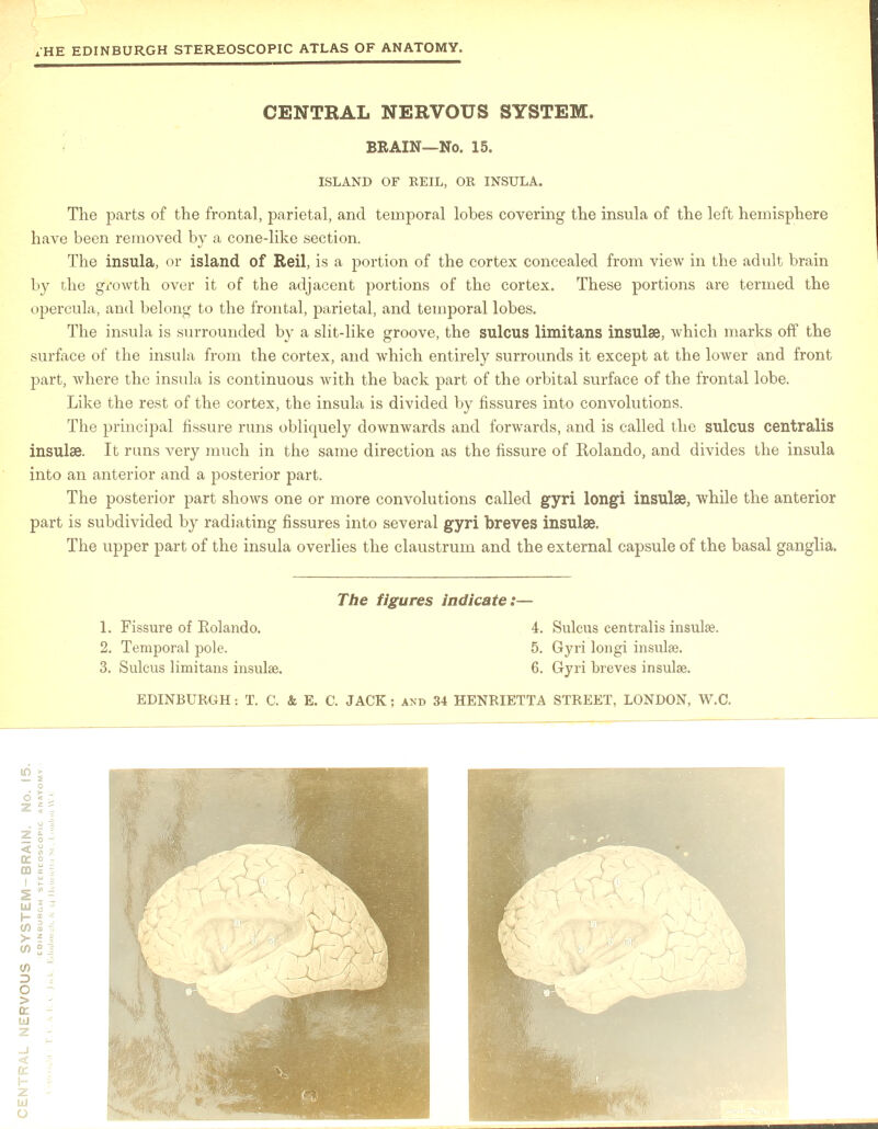 CENTRAL NERVOUS SYSTEM. BRAIN—No. 15. ISLAND OF REIL, OR INSULA. The parts of the frontal, parietal, and temporal lobes covering the insula of the left hemisphere have been removed by a cone-like section. The insula, or island of Reil, is a portion of the cortex concealed from view in the adult brain by the growth over it of the adjacent portions of the cortex. These portions are termed the opercula, and belong to the frontal, parietal, and temporal lobes. The insula is surrounded by a slit-like groove, the sulcus limitans insulae, which marks off the surface of the insula from the cortex, and which entirely surrounds it except at the lower and front part, where the insula is continuous with the back part of the orbital surface of the frontal lobe. Like the rest of the cortex, the insula is divided by fissures into convolutions. The principal fissure runs obliquely downwards and forwards, and is called the sulcus centralis insulae. It runs very much in the same direction as the fissure of Rolando, and divides the insula into an anterior and a posterior part. The posterior part shows one or more convolutions called gyri longi insulae, while the anterior part is subdivided by radiating fissures into several gyri breves insulae. The upper part of the insula overlies the claustrum and the external capsule of the basal ganglia. The figures indicate:— 1. Fissure of Eolando. 2. Temporal pole. 3. Sulcus limitans insulse. 4. Sulcus centralis insulse. 5. Gyri longi insulse. 6. Gyri breves insulse.