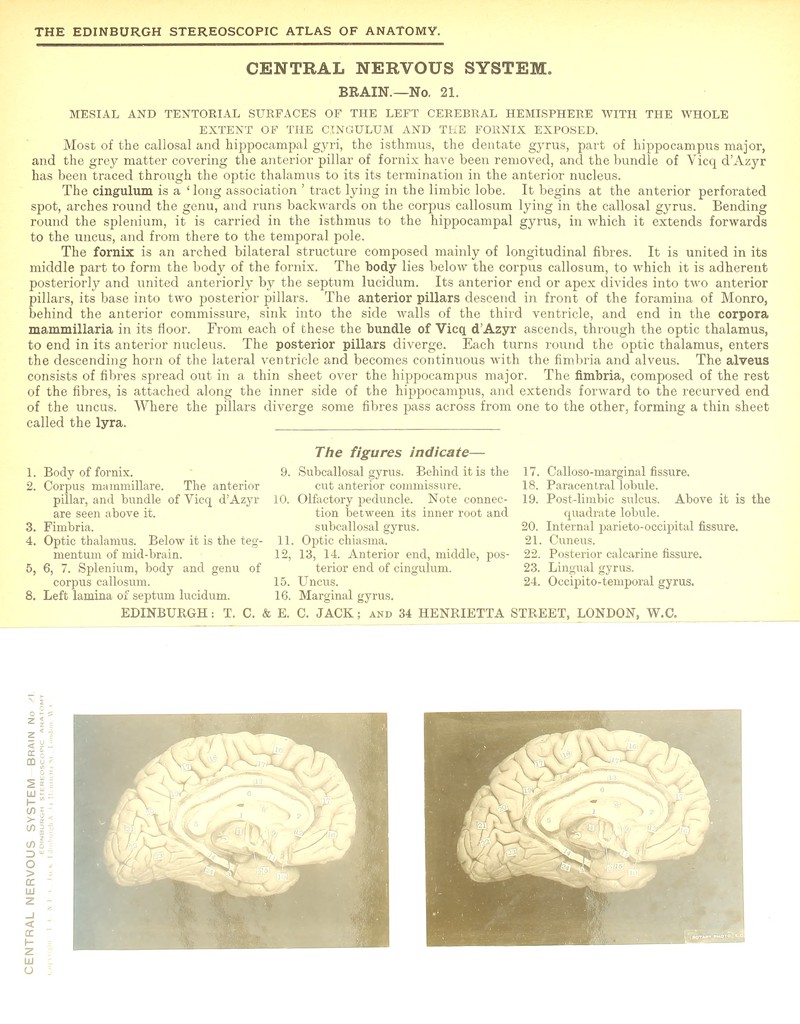 CENTRAL NERVOUS SYSTEM. BRAIN.—No. 21. MESIAL AND TENTOEIAL SURFACES OF THE LEFT CEREBRAL HEMISPHERE WITH THE WHOLE EXTENT OF THE CINGULUM AND THE FORNIX EXPOSED. Most of the callosal and hippocampal gyri, the isthmus, the dentate gyrus, part of hippocampus major, and the grey matter covering the anterior pillar of fornix have been removed, and the bundle of Vicq d'Azyr has been traced through the optic thalamus to its its termination in the anterior nucleus. The cingulum is a 'long association ' tract lying in the limbic lobe. It begins at the anterior perforated spot, arches round the genu, and runs backwards on the corpus callosum lying in the callosal gyrus. Bending round the splenium, it is carried in the isthmus to the hippocampal gyrus, in which it extends forwards to the uncus, and from there to the temporal pole. The fornix is an arched bilateral structure composed mainly of longitudinal fibres. It is united in its middle part to form the body of the fornix. The body lies below the corpus callosum, to which it is adherent posteriorly and united anteriorly by the septum lucidum. Its anterior end or apex divides into two anterior pillars, its base into two posterior pillars. The anterior pillars descend in front of the foramina of Monro, behind the anterior commissure, sink into the side walls of the third ventricle, and end in the corpora mammillaria in its floor. From each of these the bundle of Vicq. d'Azyr ascends, through the optic thalamus, to end in its anterior nucleus. The posterior pillars diverge. Each turns round the optic thalamus, enters the descending horn of the lateral ventricle and becomes continuous with the fimbria and alveus. The alveus consists of fibres spread out in a thin sheet over the hippocampus major. The fimbria, composed of the rest of the fibres, is attached along the inner side of the hippocampus, and extends forward to the recurved end of the uncus. Where the pillars diverge some fibres pass across from one to the other, forming a thin sheet called the lyra. 1. Body of fornix. 2. Corpus mammillare. The anterior pillar, and bundle of Vicq d'Azyr are seen above it. 3. Fimbria. 4. Optic thalamus. Below it is the teg- mentum of mid-brain. 5. 6, 7. Splenium, body and genu of corpus callosum. 8. Left lamina of septum lucidum. EDINBURGH: T. C. i The figures indicate— 9. Subcallosal gyrus. Behind it is the cut anterior commissure. 10. Olfactory peduncle. Note connec- tion between its inner root and subcallosal gyrus. 11. Optic chiasma. 12. 13, 14. Anterior end, middle, pos- terior end of cingulum. 15. Uncus. 16. Marginal gyrus. E. C. JACK; and 34 HENRIETTA I 17. Calloso-rnarginal fissure. 18. Paracentral lobule. 19. Post-limbic sulcus. Above it is the quadrate lobule. 20. Internal parietooccipital fissure. 21. Cuneus. 22. Posterior calcarine fissure. 23. Lingual gyrus. 24. Occipito-temporal gyrus. TREET, LONDON, W.C.