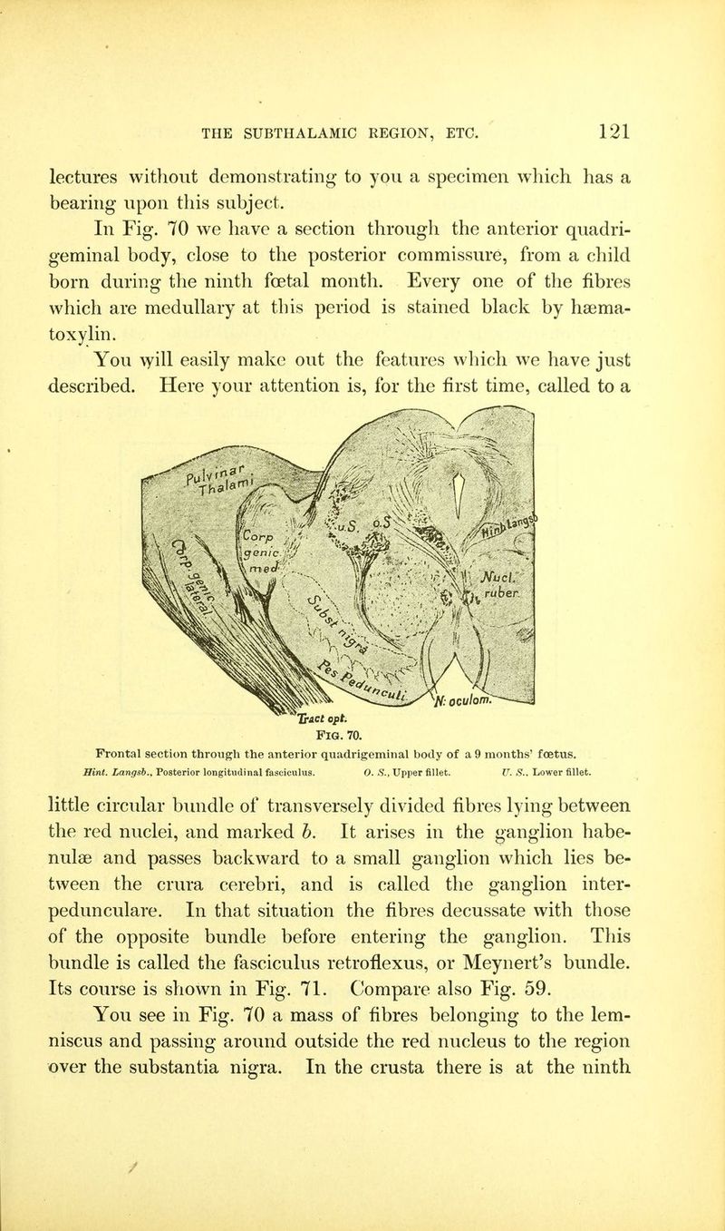 lectures without demonstrating to you a specimen which has a bearing upon this subject. In Fig. 70 we have a section through the anterior quadri- geminal body, close to the posterior commissure, from a child born during the ninth foetal month. Every one of the fibres which are medullary at this period is stained black by hsema- toxylin. You \yill easily make out the features which we have just described. Here your attention is, for the first time, called to a Fig. 70. Frontal section through the anterior quadrigeminal body of a 9 months' foetus. Hint. Langsb., Posterior longitudinal fasciculus. O. S., Upper fillet. U. S.. Lower fillet. little circular bimdle of transversely divided fibres lying between the red nuclei, and marked b. It arises in the ganglion habe- nulse and passes backward to a small ganglion which lies be- tween the crura cerebri, and is called the ganglion inter- pedunculare. In that situation the fibres decussate with those of the opposite bundle before entering the ganglion. This bundle is called the fasciculus retroflexus, or Meynert's bundle. Its course is shown in Fig. 71. Compare also Fig. 59. You see in Fig. 70 a mass of fibres belonging to the lem- niscus and passing around outside the red nucleus to the region over the substantia nigra. In the crusta there is at the ninth
