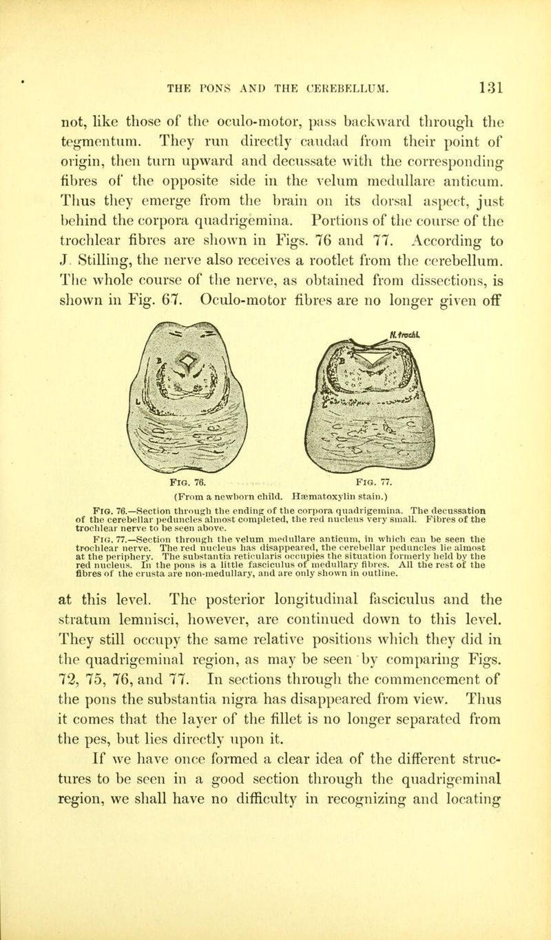 not, like those of the oculo-motor, pass backward through the tegmentum. They run directly caudad from their point of origin, then turn upward and decussate with the corresponding fibres of the opposite side in the velum medullare anticum. Thus they emerge from the brain on its dorsal aspect, just behind the corpora quadrigemina. Portions of the course of the trochlear fibres are shown in Figs. 76 and 77. According to J- Stilling, the nerve also receives a rootlet from the cerebellum. The whole course of the nerve, as obtained from dissections, is shown in Fig. 67. Oculo-motor fibres are no longer given off Fig. 76. Fig. 77. (From a newborn child. Haematoxylin stain.) Fig. 76.—Section through the ending of the corpora quadrigemina. The decussation of the cerebellar peduncles almost completed, the red nucleus very small. Fibres of the trochlear nerve to be seen above. Fig. 77.—Section through the velum medullare anticum, in which can be seen the trochlear nerve. The red nucleus has disappeared, the cerebellar peduncles lie almost at the periphery. The substantia reticularis occupies the situation formerly held by the red nucleus. In the pons is a little fasciculus of medullary fibres. All the rest of the fibres of the crusta are non-medullary, and are only shown in outline. at this level. The posterior longitudinal fasciculus and the stratum lemnisci, however, are continued down to this level. They still occupy the same relative positions which they did in the quadrigeminal region, as may be seen by comparing Figs. 72, 75, 76, and 77. In sections througli the commencement of the pons the substantia nigra has disappeared from view. Thus it comes that the layer of the fillet is no longer separated from the pes, but lies directly upon it. If we have once formed a clear idea of the different struc- tures to be seen in a good section through the quadrigeminal region, we shall have no difficulty in recognizing and locating