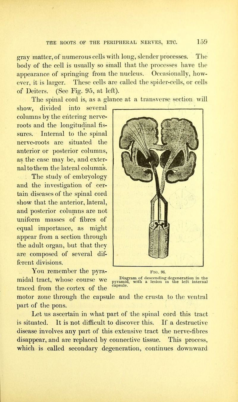 gray matter, of numerous cells with long, slender processes. The body of the cell is usually so small that the processes have the appearance of springing from the nucleus. Occasionally, how- ever, it is larger. These cells are called the spider-cells, or cells of Deiters. (See Fig. 95, at left). The spinal cord is, as a glance at a transverse section will show, divided into several columns by the entering nerve- roots and the lono:itudinal fis- sures. Internal to the spinal nerve-roots are situated the anterior or posterior columns, as the case may be, and exter- nal to them the lateral columns. The study of embryology and the investigation of cer- tain diseases of the spinal cord show that the anterior, lateral, and posterior columns are not uniform masses of fibres of equal importance, as might appear from a section through the adult organ, but that they are composed of several dif- ferent divisions. You remember the pyra- midal tract, whose course we traced from the cortex of the motor zone through the capsule and the crusta to the ventral part of the pons. Let us ascertain in what part of the spinal cord this tract is situated. It is not difficult to discover this. If a destructive disease involves any part of this extensive tract the nerve-fibres disappear, and are replaced by connective tissue. This process, which is called secondary degeneration, continues downward Fig. 96. Diagram of descending degeneration in the pyramid, witli a lesion in tlie left internal capsule.