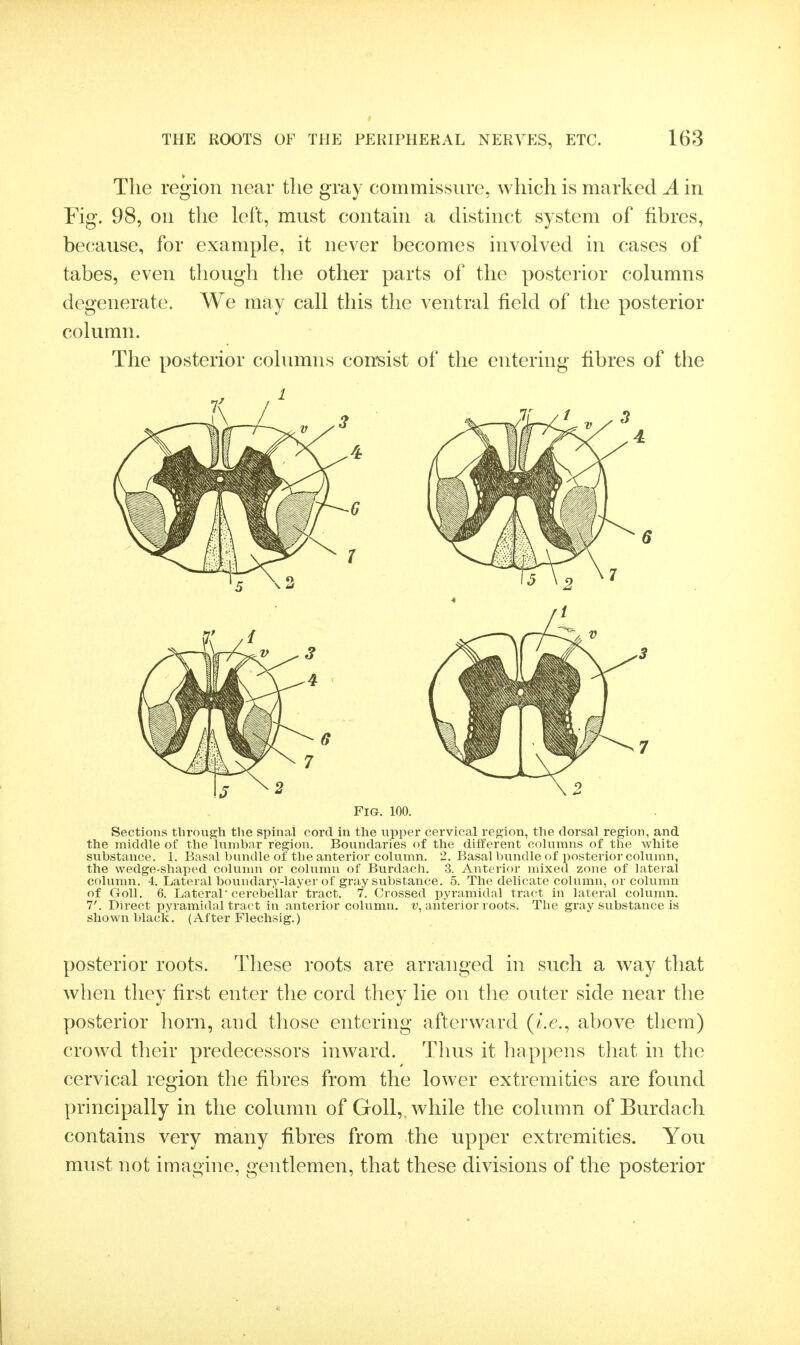 The region near the gray commissure, which is marked A in Fig. 98, on the left, must contain a distinct system of fibres, because, for example, it never becomes involved in cases of tabes, even though the other parts of the posterior columns degenerate. We may call this the ventral field of the posterior column. The posterior columns consist of the entering fibres of the Fig. 100. Sections through the spinal cord in the upper cervical region, the dorsal region, and the middle of the hinibar region. Boundaries of the different columns of the white substance. 1. Basal bundle of the anterior column. 2. Basal bundle of posterior column, the wedge-shaped colunm or column of Burdach. 3. Anterior mixed zone of lateral column. 4. Lateral boundary-layer of gray substance. 5. The delicate column, or column of Goll. 6. Lateral cerebellar tract. 7. Crossed pyramidal tract in lateral column. 7'. Direct pyramidal tract in anterior column, t^, anterior roots. The gray substance is shown black. (After Flechsig.) posterior roots. These roots are arranged in such a way tliat when they first enter the cord they lie on the outer side near the posterior horn, and those entering afterward (i.e., above them) crowd their predecessors inward. Thus it happens that in the cervical region the fibres from the lower extremities are found principally in the column of Goll,. while the column of Burdach contains very many fibres from the upper extremities. You must not imagine, gentlemen, that these divisions of the posterior