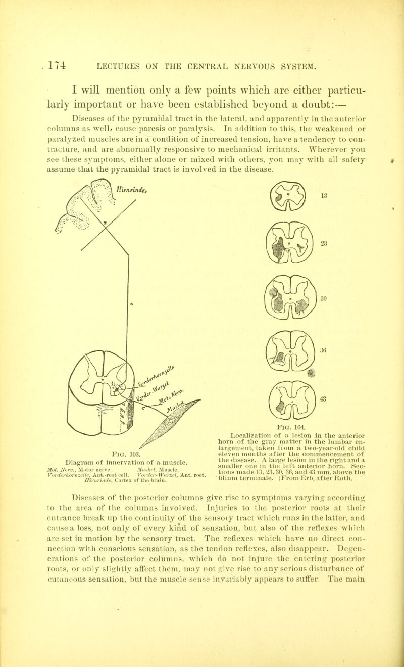 I will mention only a few points which are either particu- larly important or have been established beyond a doubt:— Diseases of the pyramidal tract in the hiteral, and apparently in the anterior columns as well,, cause paresis or paralysis. In addition to this, the weakened or paralyzed muscles are in a condition of increased tension, have a tendency to con- tracture, and are abnormally responsive to mechanical irritants. Wherever you see these symptoms, either alone or mixed with others, vou may with all safety assume that the pyramidal tract is involved in the disease. Hlrnrindef 23 Fig. 103. Diagram of innervation of a muscle. Mot. New., Motor nerve. 3IukM, Muscle. Vorderhornzelle, Ant.-root cell. Vorder-Wiirzel, Ant. root. Hivnriiidc, Cortex of the brain. 36 43 Fig. 104. Localization of a lesion in the anterior horn of the gray matter in the lumbar en- largement, taken from a two-year-old child eleven months after the commencement of the disease. A large lesion in the right and a smaller one in tlie left anterior hoi-n. Sec- tions made 13. 23,30, .86, and 43 mm. above the filium terminale. (From Erb, after Roth. Diseases of the posterior columns give rise to symptoms varying according to the area of the columns involved. Injuries to the posterior roots at their entrance break up the continuity of the sensory tract which runs in the latter, and cause a loss, not only of every kind of sensation, but also of the reflexes which are set in motion by the sensory tract. The reflexes which have no direct con- nection with conscious sensation, as the tendon reflexes, also disappear. Degen- erations of the posterior columns, which do not injure the entering posterior roots, or only slightly aff'ect them, may not give rise to an}^ serious disturbance of cutaneous sensation, but the muscle-sense ijivariably appears to suff'er. The main