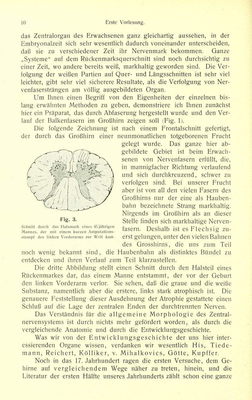 das Zentralorgan des Erwachsenen ganz gleichartig aussehen, in der Embryonalzeit sich sehr wesentlich dadurch voneinander unterscheiden, daB sie zu verschiedener Zeit ihr Nervenmark bekommen. Ganze „Systeme auf dem Riickenmarksquerschnitt sind noch durchsichtig zu einer Zeit, wo andere bereits weifi, markhaltig geworden sind. Die Ver- folgung der weifien Partien auf Quer- und Langsschnitten ist sehr viel leichter, gibt sehr viel sicherere Resultate, als die Verfolgung von Ner- venfaserstrangen am vollig ausgebildeten Organ. Um Ihnen einen Begriff von den Eigenheiten der einzelnen bis- lang erwahnten Methoden zu geben, demonstriere ich Ihnen zunachst hier ein Praparat, das durch Abfaserung hergestellt wurde und den Ver- lauf der Balkenfasern im Grofihirn zeigen soil (Fig. 1). Die folgende Zeichnung ist nach einem Frontalschnitt gefertigt, der durch das Grofihirn einer neunmonatlichen totgeborenen Frucht noch wenig bekannt sind, die Haubenbahn als distinktes Biindel zu entdecken und ihren Verlauf zum Teil klarzustellen. Die dritte Abbildung stellt einen Schnitt durch den Halsteil eines Riickenmarkes dar, das einem Manne entstammt, der vor der Geburt den linken Vorderarm verlor. Sie sehen, dafi die graue und die weifie Substanz, namentlich aber die erstere, links stark atrophisch ist. Die genauere Feststellung dieser Ausdehnung der Atrophie gestattete einen Schlufi auf die Lage der zentralen Enden der durchtrennten Nerven. Das Verstandnis fur die allgemeine Morphologie des Zentral- nervensystems ist durch nichts mehr gefordert worden, als durch die vergleichende Anatomie und durch die Entwicklungsgeschichte. Was wir von der Entwicklungsgeschichte der uns hier inter- essierenden Organe wissen, verdanken wir wesentlich His, Tiede- mann, Reichert, Kolliker, v. Mihalkovics, Gotte, Kupffer. Noch in das 17. Jahrhundert ragen die ersten Versuche, dem Ge- hirne auf vergleichendem Wege naher zu treten, hinein, und die Literatur der ersten Halfte unseres Jahrhunderts zahlt schon eine ganze Schnitt durch das Halsmark eines 45jahrigen Mannes, der mit einem kurzen Amputations- stumpf des linken Vorderarms zur Welt kam. Fig. 3. gelegt wurde. Das ganze hier ab- gebildete Gebiet ist beim Erwach- senen von Nervenfasern erfiillt, die, in mannigfacher Richtung verlaufend und sich durchkreuzend, schwer zu verfolgen sind. Bei unserer Frucht aber ist von all den vielen Fasern des Grofihirns nur der eine als Hauben- bahn bezeichnete Strang markhaltig. Nirgends im Grofihirn als an dieser Stelle finden sich markhaltige Nerven- fasern. Deshalb ist es Flechsig zu- erst gelungen, unter den vielen Bahnen des Grosshirns, die uns zum Teil