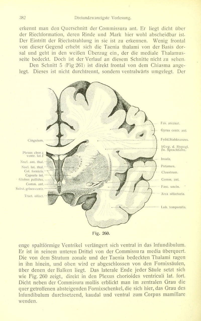 erkennt man den Querschnitt der Commissura ant. Er liegt dicht iiber der Riechformation, deren Rinde und Mark hier wohl abscheidbar ist. Der Eintritt der Riechstrahlung in sie ist zu erkennen. Wenig frontal von dieser Gegend erhebt sich die Taenia thalami von der Basis dor- sal und geht in den weifien Uberzug ein, der die mediale Thalamus- seite bedeckt. Doch ist der Verlauf an diesem Schnitte nicht zu sehen. Den Schnitt 5 (Fig 261) ist direkt frontal von dem Chiasma ange- legt. Dieses ist nicht durchtrennt, sondern ventralwarts umgelegt. Der Fig. 260. enge spaltformige Ventrikel verlangert sich ventral in das Infundibulum. Er ist in seinem unteren Drittel von der Commissura media iiberquert. Die von dem Stratum zonale und der Taenia bedeckten Thalami ragen in ihn hinein, und oben wird er abgeschlossen von den Fornixsaulen, iiber denen der Balken liegt. Das laterale Ende jeder Saule setzt sich wie Fig. 260 zeigt, direkt in den Plexus chorioides ventriculi lat. fort. Dicht neben der Commisura mollis erblickt man im zentralen Grau die quer getroffenen absteigenden Fornixschenkel, die sich hier, das Grau des Infundibulum durchsetzend, kaudal und ventral zum Corpus mamillare wenden.