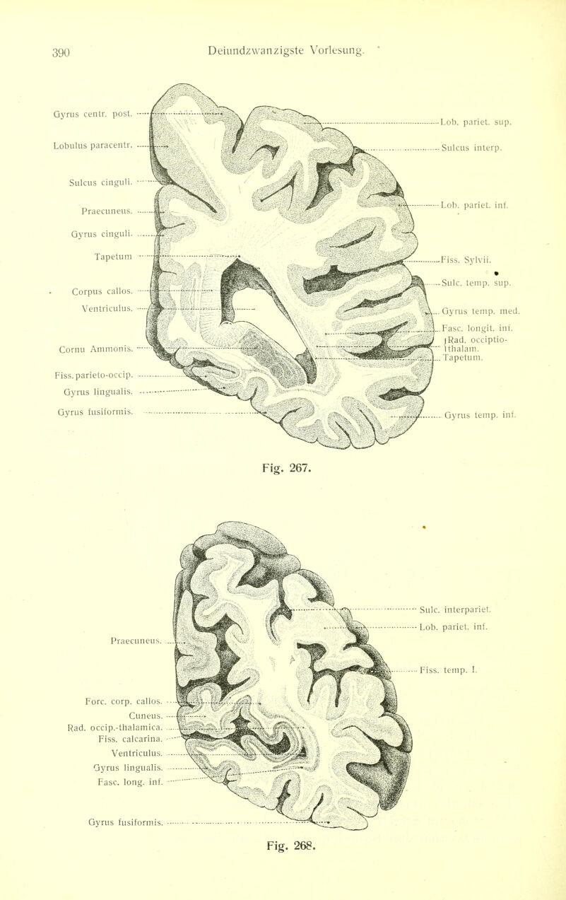 Gyrus centr. post. Lobulus paracentr. Sulcus cinguli. Praecuneus. Gyrus cinguli. Tapetum Corpus callos. Ventriculus. Cornu Ammonis. — Fiss.parieto-occip. Gyrus lingualis. Gyrus fusiformis. Lob. pariet. sup. Sulcus interp. Lob. pariet. inf. Fiss. Sylvii. Sulc. temp. sup. Gyrus temp. med. Fasc. longit. int. (Rad. occiptio- ithalam. Tapetum. Gyrus temp. inf. Fig. 267. Praecuneus. Fore. corp. callos. Cuneus. Rad. occip.-thalamica. Fiss. calcarina. Ventriculus. Gyrus lingualis. Fasc. long. inf. Gyrus fusiformis. - Sulc. interpariet. •- Lob. pariet. inf. - Fiss. temp. I. Fig. 268.