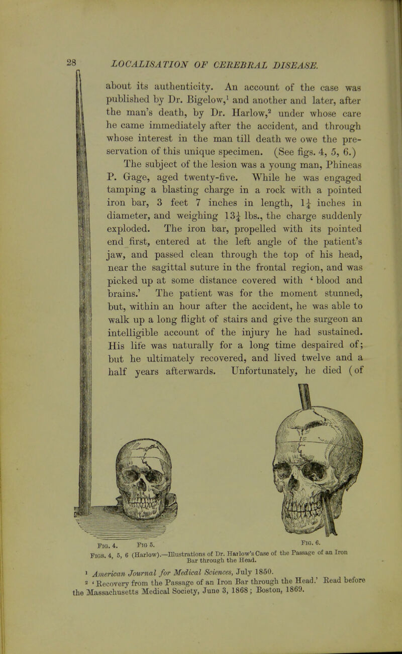 about its authenticity. An account of the case was published by Dr. Bigelow,1 and another and later, after the man's death, by Dr. Harlow,2 under whose care he came immediately after the accident, and through whose interest in the man till death we owe the pre- servation of this unique specimen. (See figs. 4, 5, 6.) The subject of the lesion was a young man, Phineas P. Gage, aged twenty-five. While he was engaged tamping a blasting charge in a rock with a pointed iron bar, 3 feet 7 inches in length, 1£ inches in diameter, and weighing 13£ lbs., the charge suddenly exploded. The iron bar, propelled with its pointed end first, entered at the left angle of the patient's jaw, and passed clean through the top of his head, near the sagittal suture in the frontal region, and was picked up at some distance covered with 4 blood and brains.' The patient was for the moment stunned, but, within an hour after the accident, he was able to walk up a long flight of stairs and give the surgeon an intelligible account of the injury he had sustained. His life was naturally for a long time despaired of; but he ultimately recovered, and lived twelve and a half years afterwards. Unfortunately, he died (of Fig. 4. Fig 5. Fig. 6. Figs. 4 5, 6 (Harlow).—Illustrations of Dr. Harlow's Case of the Passage of an Iron Bar through the Head. 1 American Journal for Medical Sciences, July 1850. 2 «Recovery from the Passage of an Iron Bar through the Head.' Read before the Massachusetts Medical Society, June 3, 1868; Boston, 1869.