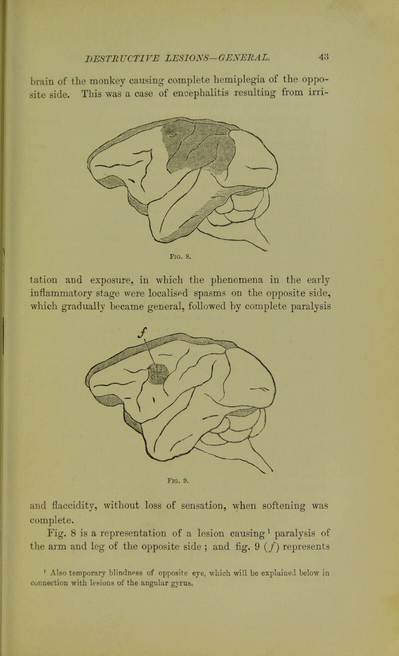 brain of the monkey causing complete hemiplegia of the oppo- site side. This was a case of encephalitis resulting from irri- Fig. 8. tation and exposure, in which the phenomena in the early inflammatory stage were localised spasms on the opposite side, which gradually became general, followed by complete paralysis Fig. 9. and flaccidity, without loss of sensation, when softening was complete. Fig. 8 is a representation of a lesion causing1 paralysis of the arm and leg of the opposite side ; and fig. 9 (/) represents 1 Also temporary blindness of opposite eye, which will be explaine.1 below in connection with lesions of the angular gyrus.