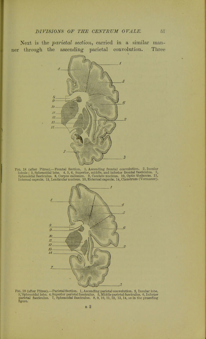 Next is the parietal section, carried in a similar man- ner through the ascending parietal convolution. Three Fig. 18 (after Pitres).—Frontal Section. 1, Ascending frontal convolution. 2, Insular lobule; 3, Sphenoidal lobe. 4, 5, 6, Superior, middle, and inferior frontal fasciculus. 7, Sphenoidal fasciculus. 8, Corpus callosum. 9, Caudate nucleus. 10, Optic thalamus. 11, Internal capsule. 12, Lenticular nucleus. 13, External capsule. 14, Claustrum (Vonnauer). Fio. 19 (after Pitres).—Parietal Section. 1, Ascending parietal convolution. 2, Insular lobe. 3,Sphenoidal lobe. 4. Superior parietal fasciculus. 5, Middle parietal fasciculus. 6, Inferior parietal fasciculus. 7, Sphenoidal fasciculus. 8, 9,10,11,12, 13,14, as in the preceding figure.