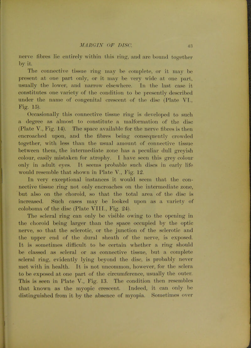 .VAr?ary of insa nerve fibres lie entirely within this ring, and are bound tog-ether by it. The connective tissue ring may be complete, or it may be present at one part only, or it may be very wide at one part, usually the lower, and narrow elsewliere. In the last case it constitutes one variety of the condition to be presently described under the name of congenital crescent of the disc (Plate VT., Fig. 15). Occasionally this connective tissue ring is developed to such a degree as almost to constitute a malformation of the disc (Plate v.. Fig. 14). The space available for the nerve fibres is then encroached upon, and the fibres being consequently crowded together, with less than the usual amount of connective tissue between them, the intermediate zone has a peculiar dull greyish colour, easily mistaken for atrophy. I have seen this grey colour only in adult eyes. It seems probable such discs in early life would resemble that shown in Plate V., Fig. 12. In very exceptional instances it would seem that the con- nective tissue ring not only encroaches on the intermediate zone, but also on the choroid, so that the total area of the disc is increased. Such cases may be looked upon as a variety of coloboma of the disc (Plate VIII., Fig. 24). The scleral ring can only be visible owing to the opening in the choroid being larger than the space occupied by the optic nerve, so that the sclerotic, or the junction of the sclerotic and the upper end of the dural sheath of the nerve, is exposed. It is sometimes difficult to be certain whether a ring should be classed as scleral or as connective tissue, but a complete scleral ring, evidently lying beyond the disc, is probably never met with in health. It is not uncommon, however, for the sclera to be exposed at one part of the circumference, usually the outer. This is seen in Plate V., Fig. 13. The condition then resembles that known as the myopic crescent. Indeed, it can only be distinguished from it by the absence of myopia. Sometimes over