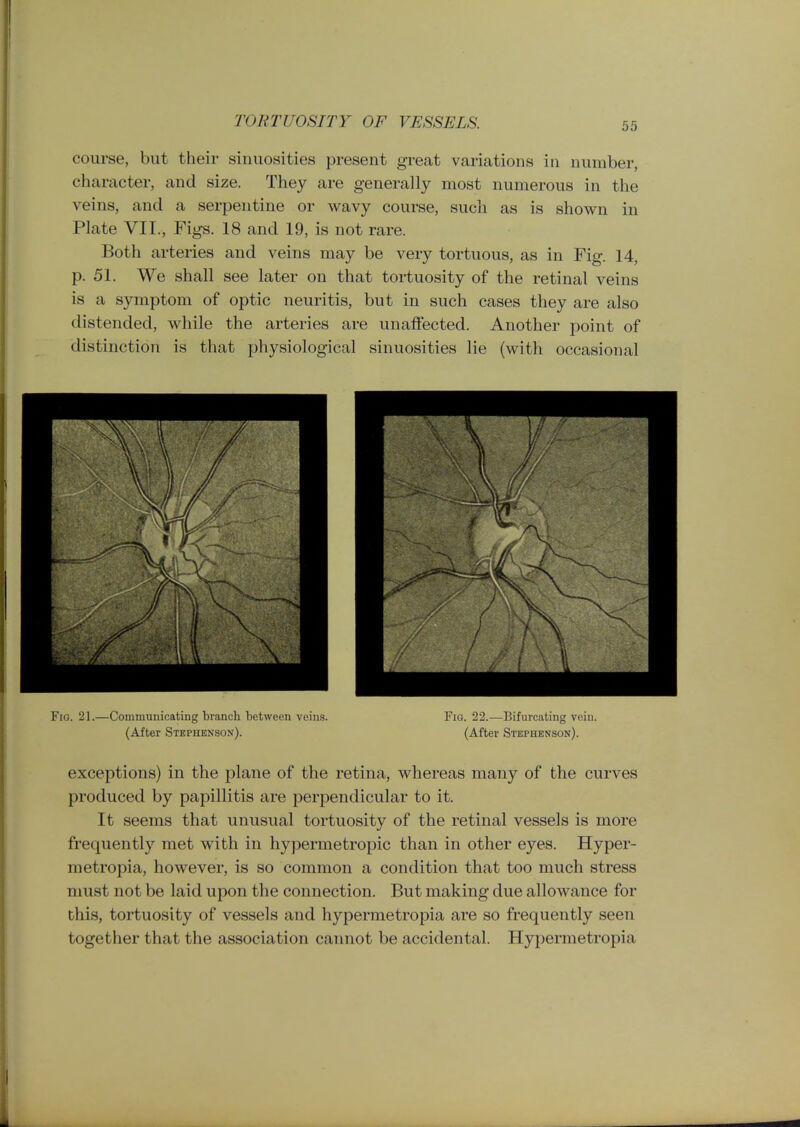 course, but their sinuosities present great variations in number, character, and size. They are generally most numerous in the veins, and a serpentine or wavy course, such as is shown in Plate VII., Figs. 18 and 19, is not rare. Both arteries and veins may be very tortuous, as in Fig. 14, p. 51. We shall see later on that tortuosity of the retinal veins is a symptom of optic neuritis, but in such cases they are also distended, while the arteries are unaffected. Another point of distinction is that physiological sinuosities lie (with occasional 10. 21.—Communicating branch between veins. Fig. 22.—Bifurcating vein. (After Stephenson). (After Stephenson). exceptions) in the plane of the retina, whereas many of the curves produced by papillitis are perpendicular to it. It seems that unusual tortuosity of the retinal vessels is more frequently met with in hypermetropic than in other eyes. Hyper- metropia, however, is so common a condition that too much stress must not be laid upon the connection. But making due allowance for this, tortuosity of vessels and hypermetropia are so frequently seen together that the association cannot be accidental. Hypermetropia