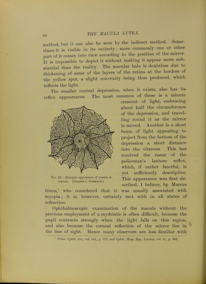 method, but it can also be seen by the indirect method. Some- times it is visible in its entirety; more commonly one or other part of it comes into view according to the position of the mirror. It is impossible to depict it without making it appear more sub- stantial than the reality. The macular halo is doubtless due to thickening of some of the layers of the retina at the borders of the yellow spot, a slight convexity being thus produced, which reflects the light. The smaller central depression, when it exists, also has its reflex appearances. The most common of these is a minute crescent of light, embracing about half the circumference of the depression, and travel- ling round it as the min-or is moved. Another is a short beam of light appearing to project from the bottom of the depression a short distance into the vitreous. This has received the name of the policeman's lantern reflex, which, if rather fanciful, is yet sufficiently descriptive. This appearance was first de- scribed, I believe, by Marcus Fig. 29. —Entoptic appearance of vessels at macula. (Graefe u. Saemisch.) Gunn,' who considered that it was usually associated with myopia; it is, however, certainly met with in all states of refraction. Ophthalmoscopic examination of the macula without the previous employment of a mydriatic is often difficult, because the pupil contracts strongly when the light falls on this region, and also because the corneal reflection of the mirror lies in the line of sight. Hence many observers are less familiar with * Trans. Ophth. Soc, vol. viii., p. 173, and OjMh. Hasp. Rep., London, vol. xi., p. 348.