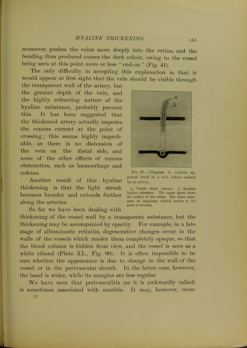 HYALINE THICKENING. 161 moreover, pushes the veins more deeply into the retina, and the bending thus produced causes the dark colour, owing to the vessel being seen at this point more or less  end-on  (Fig. 41). The only difficulty in accepting this explanation is, that it would appear at first sight that the vein should be visible through the transparent wall of the artery, but the greater depth of the vein, and the highly refracting nature of the hyaline substance, probably prevent this. It has been suggested that the thickened artery actually impedes the venous current at the point of crossing; this seems highly improb- able, as there is no distension of the vein on the distal side, and none of the other effects of venous obstruction, such as haemorrhage and oedema. —l^i^^grf^m to explain ap- . , , f ^ • 1 T parent break in a vein where crossed Another result of this hyaline by an artery, thickening is that the light streak becomes broader and extends further along the arteries. So far we have been dealing with thickening of the vessel wall by a transparent substance, but the thickening may be accompanied by opacity. For example, in a late stage of albuminuric retinitis, degenerative changes occur in the walls of the vessels which render them completely opaque, so that the blood column is hidden from view, and the vessel is seen as a white riband (Plate XL., Fig. 90). It is often impossible to be sure whether the appearance is due to change in the wall of the vessel or in the perivascular sheath. In the latter case, however, the band is wider, while its margins are less regular. We have seen that perivasculitis (as it is awkwardly called) is sometimes associated with neuritis. It may, however, occur 21 a, Visible blood column; 4, invisible hyaline substance. Tlie upper figure shows the surface of the retina. The lower repre- sents an imaginary vertical section at the point of crossing.