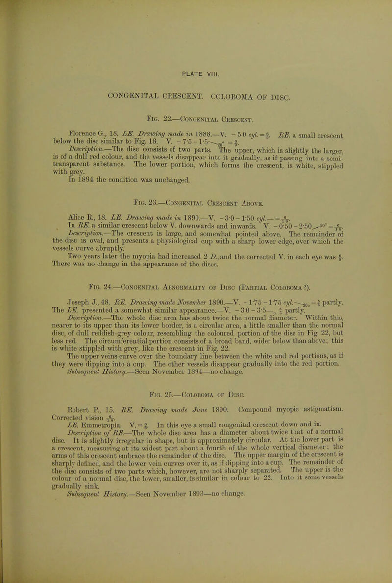 CONGENITAL CEESCENT. COLOBOMA OF DISC. Fig. 22.—Congenitax Crescent. Florence G., 18. LE. Drmviiuj made in 1888.—V. - 5-0 cyZ.=f BE. a small crescent below the disc similar to Fig. 18. V. -7'5- l-S-^-^g^o = Description.—The disc consists of two parts. The upper, which is slightly the larger, is of a dull red colour, and the vessels disappear into it gradually, as if passing into a semi- transparent substance. The lower portion, which forms the crescent, is white, stippled \vith grey. In 1894 the condition was unchanged. Fig. 23.—Congenital Crescent Above. Alice R, 18. LE. Di-awing made in 1890.—V. -3-0-1-50 cyl.— = j% In EE. a similar crescent below V. downwards and inwards. V. - 0-50 - 2-50^^° = Descnption.—The crescent is large, and somewhat pointed above. The remainder of the disc is oval, and presents a physiological cup with a sharp lower edge, over which the vessels curve abruptly. Two years later the myopia had increased 2 B., and the corrected V. in each eye was ^. There was no change in the appearance of the discs. Fig. 24.—Congenital Abnormality of Disc (Partial Coloboma ?). Joseph J., 48. RE. Drawing made November 1890.—V. - 1-75 - 1-75 cyl.~-^^^ = i; partly. The LE. presented a somewhat similar appearance.—V. - 3'0 - 3-5—^ f partly. Description.—The whole disc area has about twice the normal diameter. Within this, nearer to its upper than its lower border, is a circular area, a little smaller than the normal disc, of dull reddish-grey colour, resembling the coloured portion of the disc in Fig. 22, but less red. The circumferential portion consists of a broad band, wider below than above; this is wliite stippled with grey, like the crescent in Fig. 22. The upper veins curve over the boundary line between the white and red portions, as if they were dipping into a cup. The other vessels disappear gradually into the red portion. Sid)sequent History.—Seen November 1894—no change. Fig. 25.—Coloboma of Disc. Robert P., 15. BE. Draioing made June 1890. Compound myopic astigmatism. Corrected vision j^. LE. Emmetropia. V. = In this eye a small congenital crescent down and in. Descnption of BE.—The whole disc area has a diameter about twice that of a normal disc. It is slightly irregular in shape, but is approximately circular. At the lower part is a crescent, measuring at its widest part about a fourth of the whole vertical diameter; the arms of this crescent embrace the remainder of the disc. The upper margin of the crescent is sharply defined, and the lower vein curves over it, as if dipping into a cup. Tlie remainder of the disc consists of two parts which, however, are not sliarply separated. Tlie upper is the colour of a normal disc, the lower, smaller, is similar in colour to 22. Into it some vessels gradually sink. Subsequent History.—Seen November 1893—no change.