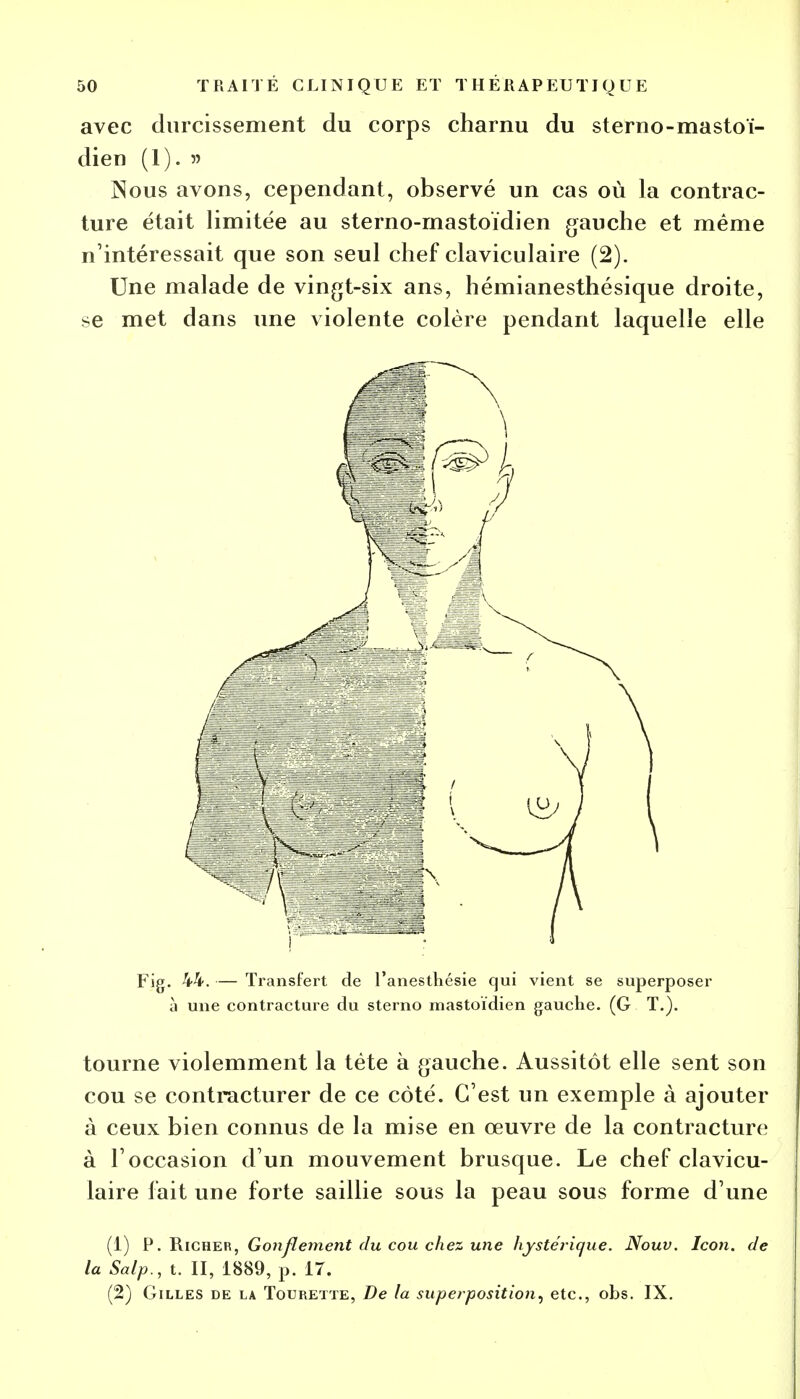 avec durcissement du corps charnu du sterno-mastoï- dien (1). 55 Nous avons, cependant, observé un cas où la contrac- ture était limitée au sterno-rnastoïdien gauche et même n'intéressait que son seul chef claviculaire (2). Une malade de vingt-six ans, hémianesthésique droite, se met dans une violente colère pendant laquelle elle Fig. 44. — Transfert de l'anesthésie qui vient se superposer à une contracture du sterno mastoïdien gauche. (G T.). tourne violemment la téte à gauche. Aussitôt elle sent son cou se contracturer de ce côté. C'est un exemple à ajouter à ceux bien connus de la mise en œuvre de la contracture à l'occasion d'un mouvement brusque. Le chef clavicu- laire fait une forte saillie sous la peau sous forme d'une (1) P. Richer, Gonflement du cou chez une hystérique. Nouv. Icon. de la Salp., t. II, 1889, p. 17. (2) Gilles de la Tourette, De la superposition, etc., obs. IX.