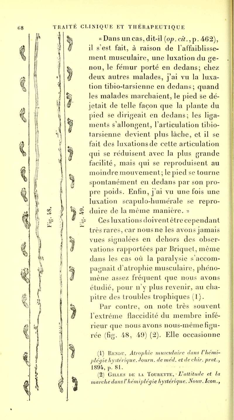 Ï« Dans un cas, dit-il (op. cit.,p. 462), il s'est fait, à raison de l'affaiblisse- ment musculaire, une luxation du ge- Ïnou, le fémur porté en dedans; chez deux autres malades, j'ai vu la luxa- tion tibio-tarsienne en dedans; quand & les malades marchaient, le pied se dé- 8 jetait de telle façon que la plante du I ^ pied se dirigeait en dedans; les liga- nients s'allongent, l'articulation tibio- tarsienne devient plus lâche, et il se fait des luxations de cette articulation jj qui se réduisent avec la plus grande facilité, mais qui se reproduisent au ... moindre mouvement ; le pied se tourne spontanément en dedans par son pro- pre poids. Enfin, j'ai vu une fois une luxation scapulo-humérale se repro- duire de la même manière, v Ces luxations cloiventêtre cependant très rares, car nous ne les avons jamais vues signalées en dehors des obser- vations rapportées par Briquet, même dans les cas où la paralysie s'accom- pagnait d'atrophie musculaire, phéno- mène assez fréquent que nous avons étudié, pour n'y plus revenir, au cha- pitre des troubles trophiques (1). Par contre, on note très souvent l'extrême flaccidité du membre infé- rieur que nous avons nous-mème figu- rée (fig. 48, 49) (2). Elle occasionne t.. ï (1) Rendu, Atrophie musculaire dans l'hémi- plégie hystérique. Journ. de méd. et de chir. prat., 1894, p. 81. (2) Gilles de la Toerette, • L'altitude et la marche dans l'hémiplégie hystérique. Nouv. Icon.,