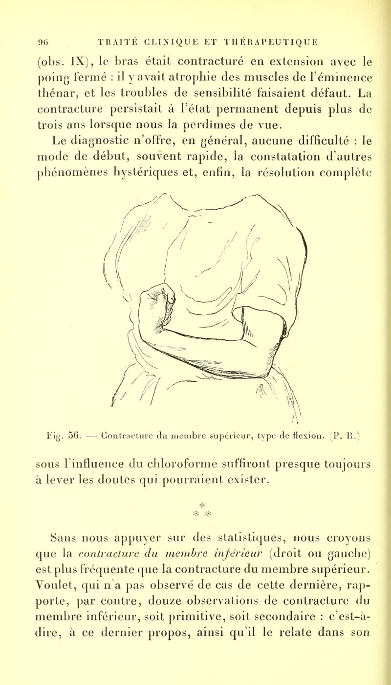 (obs. IX), le î>ras était contracture en extension avec le poing fermé : il y avait atrophie des muscles de l'éminence thénar, et les troubles de sensibilité faisaient défaut. La contracture persistait à l'état permanent depuis plus de trois ans lorsque nous la perdîmes de vue. Le diagnostic n'offre, en général, aucune difficulté : le mode de début, souvent rapide, la constatation d'autres phénomènes hystériques et, enfin, la résolution complète Fig. 56. — Contracture du membre supérieur, type de flexion. (P. H.) sous l'influence du chloroforme suffiront presque toujours à lever les doutes qui pourraient exister. Sans nous appuyer sur des statistiques, nous croyons que la contracture du membre inférieur (droit ou gauche) est plus fréquente que la contracture du membre supérieur. Voulet, qui n'a pas observé de cas de cette dernière, rap- porte, par contre, douze observations de contracture du membre inférieur, soit primitive, soit secondaire : c'est-à- dire, à ce dernier propos, ainsi qu'il le relate dans son