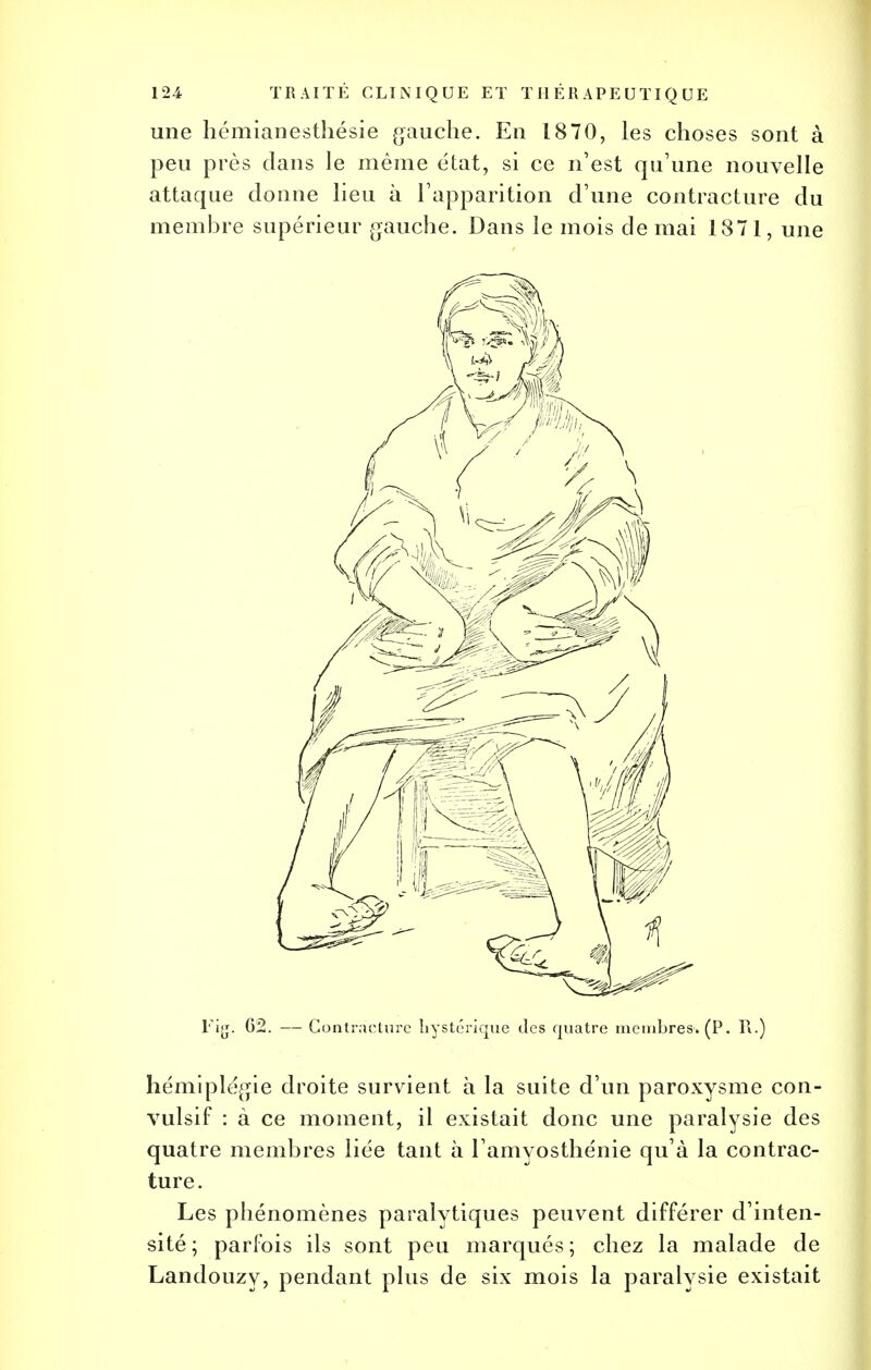 une liémianesthésie gauche. En 1870, les choses sont à peu près dans le même état, si ce n'est qu'une nouvelle attaque donne lieu à l'apparition d'une contracture du membre supérieur gauche. Dans le mois de mai 1871, une Fig. 62. — Contracture hystérique des quatre membres. (P. R.) hémiplégie droite survient à la suite d'un paroxysme con- vulsif : à ce moment, il existait donc une paralysie des quatre membres liée tant à l'amyosthénie qu'à la contrac- ture. Les phénomènes paralytiques peuvent différer d'inten- sité ; parfois ils sont peu marqués; chez la malade de Landouzy, pendant plus de six mois la paralysie existait