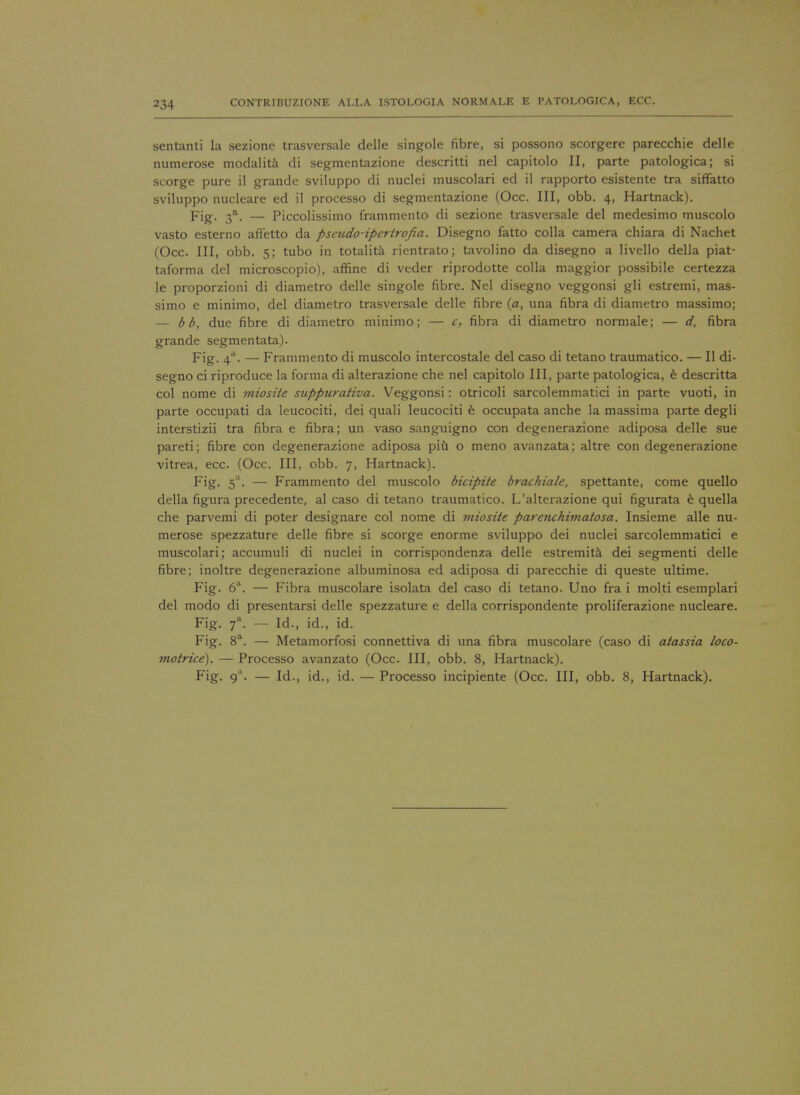 sentanti la sezione trasversale delle singole fibre, si possono scorgere parecchie delle numerose modalita di segmentazione descritti nel capitolo II, parte patologica; si scorge pure il grande sviluppo di nuclei muscolari ed il rapporto esistente tra siffatto sviluppo nucleare ed il processo di segmentazione (Occ. Ill, obb. 4, Hartnack). Fig. 3a. — Piccolissimo frammento di sezione trasversale del medesimo muscolo vasto esterno affetto da pseudo-ipcrirofia. Disegno fatto colla camera chiara di Nachet (Occ. Ill, obb. 5; tubo in totalita rientrato; tavolino da disegno a livello della piat- taforma del microscopio), affine di veder riprodotte colla maggior possibile certezza le proporzioni di diametro delle singole fibre. Nel disegno veggonsi gli estremi, mas- simo e minimo, del diametro trasversale delle fibre (a, una fibra di diametro massimo; — bb, due fibre di diametro minimo; — c, fibra di diametro normale; — d, fibra grande segmentata). Fig. 4*. — Frammento di muscolo intercostale del caso di tetano traumatico. — II di- segno ci riproduce la forma di alterazione che nel capitolo III, parte patologica, e descritta col nome di miosiie suppurativa. Veggonsi: otricoli sarcolemmatici in parte vuoti, in parte occupati da leucociti, dei quali leucociti e occupata anche la massima parte degli interstizii tra fibra e fibra; un vaso sanguigno con degenerazione adiposa delle sue pareti; fibre con degenerazione adiposa piu o meno avanzata; altre con degenerazione vitrea, ecc. (Occ. Ill, obb. 7, Hartnack). Fig. 5'. — Frammento del muscolo bicipite brachiale, spettante, come quello della figura precedente, al caso di tetano traumatico. L'alterazione qui figurata e quella che parvemi di poter designare col nome di miosite parenchimatosa. Insieme alle nu- merose spezzature delle fibre si scorge enorme sviluppo dei nuclei sarcolemmatici e muscolari; accumuli di nuclei in corrispondenza delle estremita dei segmenti delle fibre; inoltre degenerazione albuminosa ed adiposa di parecchie di queste ultime. Fig. 6a. — Fibra muscolare isolata del caso di tetano. Uno fra i molti esemplari del modo di presentarsi delle spezzature e della corrispondente proliferazione nucleare. Fig. f. — Id., id., id. Fig. 8a. — Metamorfosi connettiva di una fibra muscolare (caso di atassia loco- motrice). — Processo avanzato (Occ. Ill, obb. 8, Hartnack). Fig- 9a- — Id-> id., id. — Processo incipiente (Occ. Ill, obb. 8, Hartnack).