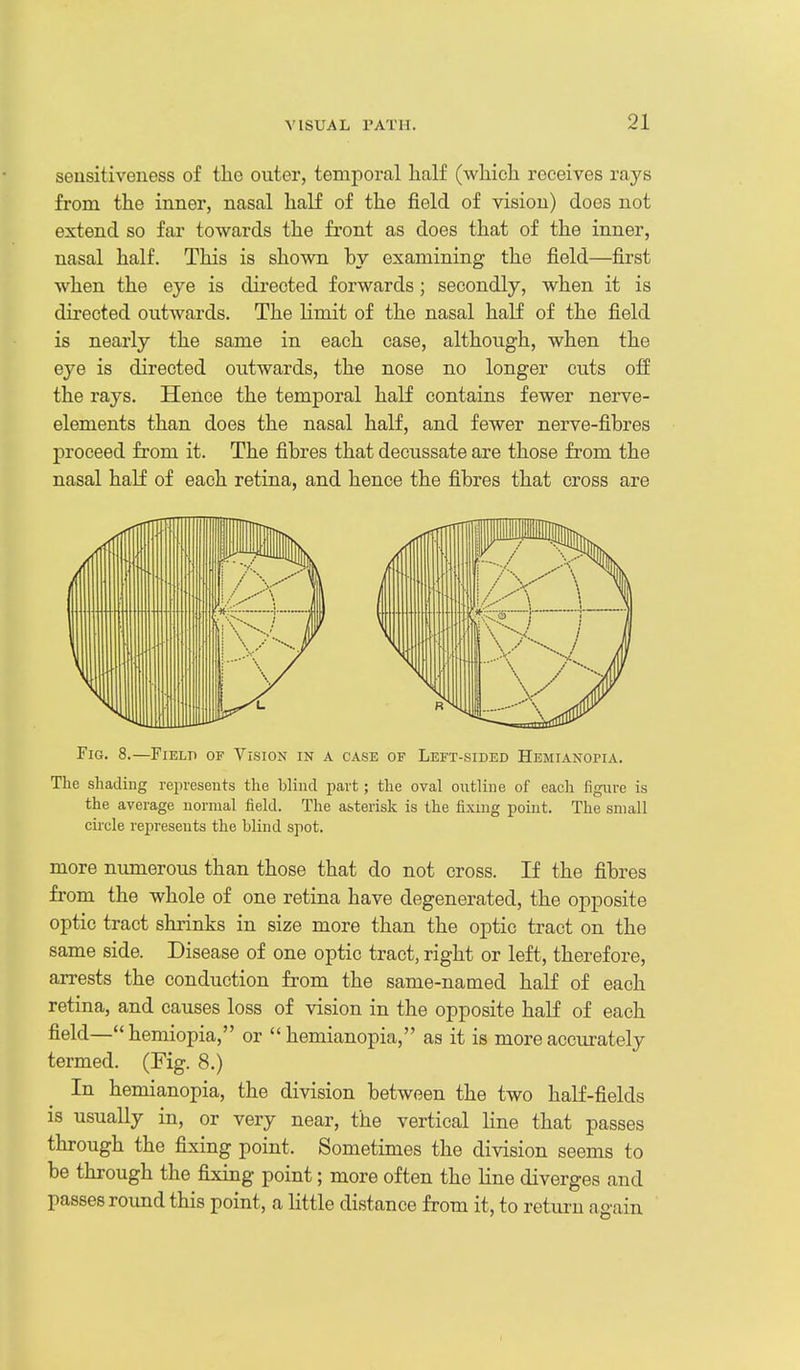 sensitiveness of the outer, temporal half (which receives rays from the inner, nasal half of the field of vision) does not extend so far towards the front as does that of the inner, nasal half. This is shown by examining the field—first when the eye is directed forwards; secondly, when it is directed outwards. The limit of the nasal half of the field is nearly the same in each case, although, when the eye is directed outwards, the nose no longer cuts off the rays. Hence the temporal half contains fewer nerve- elements than does the nasal half, and fewer nerve-fibres proceed from it. The fibres that decussate are those from the nasal half of each retina, and hence the fibres that cross are Fig. 8.—Field of Vision in a case of Left-sided HEMiANoriA. The shading represents the blind part; the oval outline of eacli figure is the average normal field. The asterisk is the fixing point. The small circle represents the blind spot. more numerous than those that do not cross. If the fibres from the whole of one retina have degenerated, the opposite optic tract shrinks in size more than the optic tract on the same side. Disease of one optic tract, right or left, therefore, arrests the conduction from the same-named half of each retina, and causes loss of vision in the opposite half of each field— hemiopia, or  hemianopia, as it is more accui^ately termed. (Fig. 8.) In hemianopia, the division between the two half-fields is usually in, or very near, the vertical line that passes through the fixing point. Sometimes the division seems to be through the fixing point; more often the line diverges and passes round this point, a little distance from it, to return again