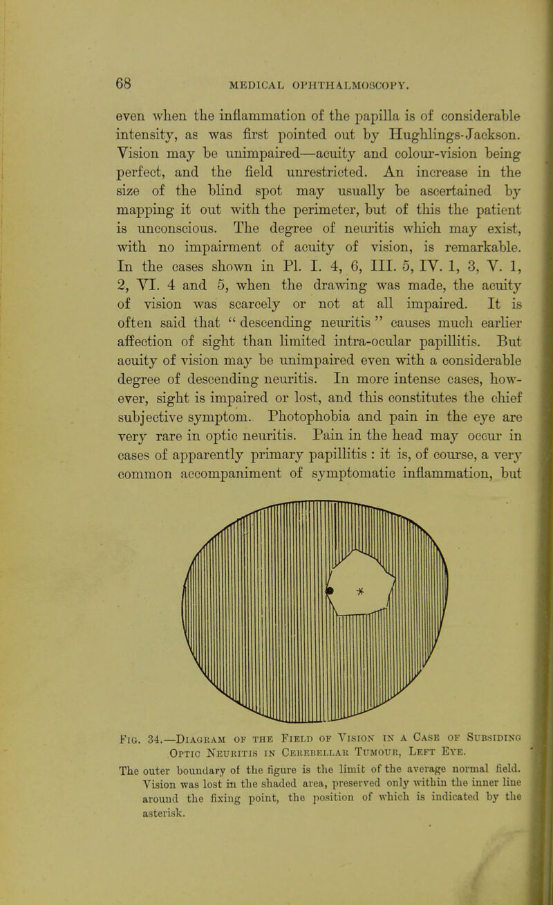 even when the inflammation of the papilla is of considerable intensity, as was first pointed out by Hughlings-Jackson. Vision may be unimpaired—acuity and colom*-vision being perfect, and the field unrestricted. An increase in the size of the blind spot may usually be ascertained by mapping it out with the perimeter, but of this the patient is unconscious. The degree of neiu’itis which may exist, with no impairment of acuity of vision, is remarkable. In the cases shown in PI. I. 4, 6, III. 5, IV. 1, 3, V. 1, 2, VI. 4 and 5, when the drawing was made, the acuity of vision was scarcely or not at all impaired. It is often said that “ descending neuritis ” causes much earlier affection of sight than hmited intra-ocular papillitis. But acuity of vision may be unimpaired even with a considerable degree of descending neuritis. In more intense cases, how- ever, sight is impaired or lost, and this constitutes the chief subjective symptom. Photophobia and pain in the eye are very rare in optic neuritis. Pain in the head may occur in cases of apparently primary papillitis : it is, of course, a very common accompaniment of symptomatic inflammation, but Fig. 34.—Diagkam of the Field of Vision in a Case of Subsiding Optic Neuritis in Cerebellar Tumour, Left Eye. The outer boundary of the figure is the limit of the average normal field. Vision was lost in the shaded area, preserved only within the inner line around the fixing point, the jiosition of which is indicated by the asterisk.