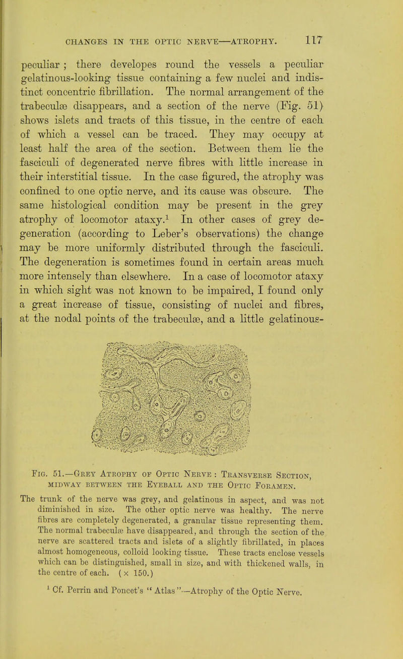 peculiar ; there developes round the vessels a peculiar gelatinous-looking tissue containing a few nuclei and indis- tinct concentric fibrillation. The normal arrangement of the traheculce disappears, and a section of the nerve (Fig. 51) shows islets and tracts of this tissue, in the centre of each of which a vessel can he traced. They may occupy at least half the area of the section. Between them lie the fasciculi of degenerated nerve fibres with little increase in their interstitial tissue. In the case figured, the atrophy was- confined to one optic nerve, and its cause was obscure. The same histological condition may be present in the grey atrophy of locomotor ataxy.^ In other cases of grey de- generation (according to Leber’s observations) the change ^ niay be more uniformly distributed through the fasciculi. ' The degeneration is sometimes found in certain areas much more intensely than elsewhere. In a case of locomotor ataxy in which sight was not known to be impaired, I found only a great increase of tissue, consisting of nuclei and fibres, at the nodal points of the trabeculae, and a little gelatinous- Fig. 51.—Grey Atrophy of Optic Nerve : Transverse Section, MIDWAY BETWEEN THE EyEBALL AND THE OPTIC FORAMEN. The trunk of the nerve was grey, and gelatinous in aspect, and was not diminished in size. The other optic nerve was healthy. The nerve fibres are completely degenerated, a granular tissue representing them. The normal trabeculie have disappeared, and through the section of the nerve are scattered tracts and islets of a slightly fibrillated, in places almost homogeneous, colloid looking tissue. These tracts enclose vessels which can be distinguished, small in size, and with thickened walls, in the centre of each. { x 150.) ^ Of. Perrin and Poncet’s “ Atlas’’—Atrophy of the Optic Nerve.